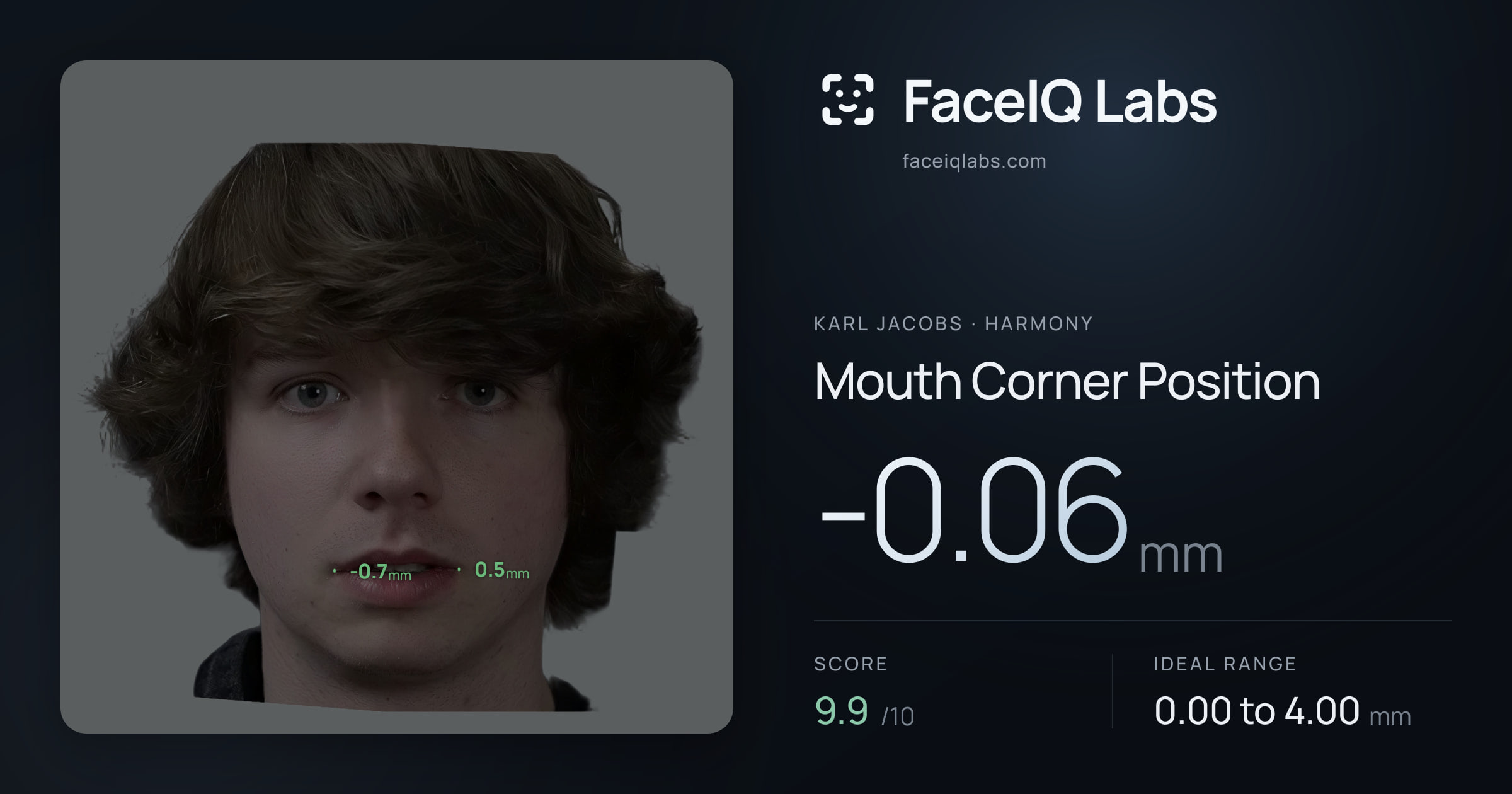 Karl Jacobs Mouth Corner Position: -0.06mm, drawn on the photo