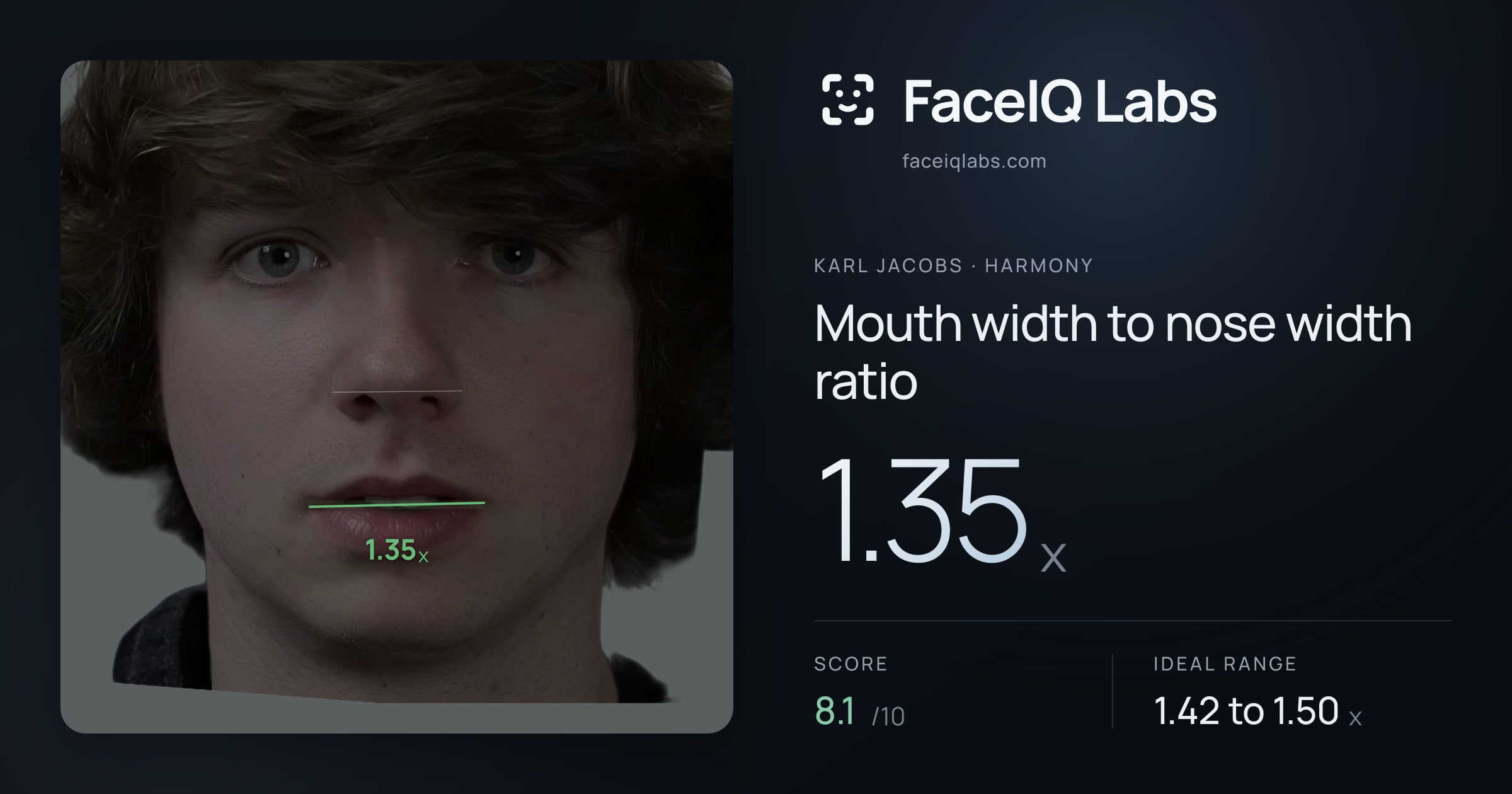 Karl Jacobs Mouth width to nose width ratio: 1.35x, drawn on the photo