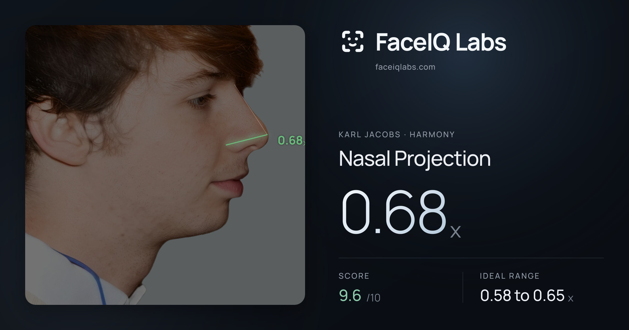 Karl Jacobs Nasal Projection: 0.68x, drawn on the photo