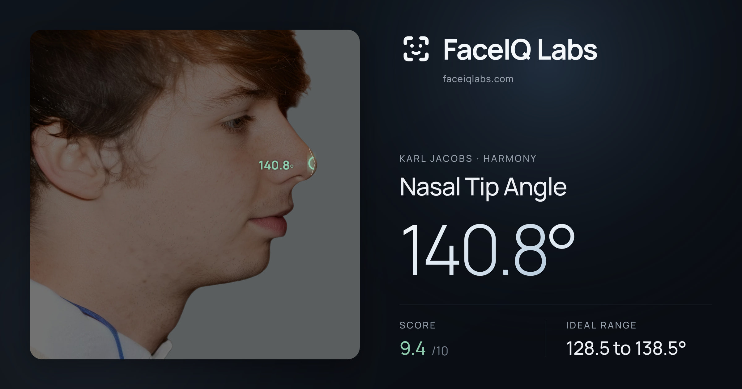 Karl Jacobs Nasal Tip Angle: 140.8°, drawn on the photo