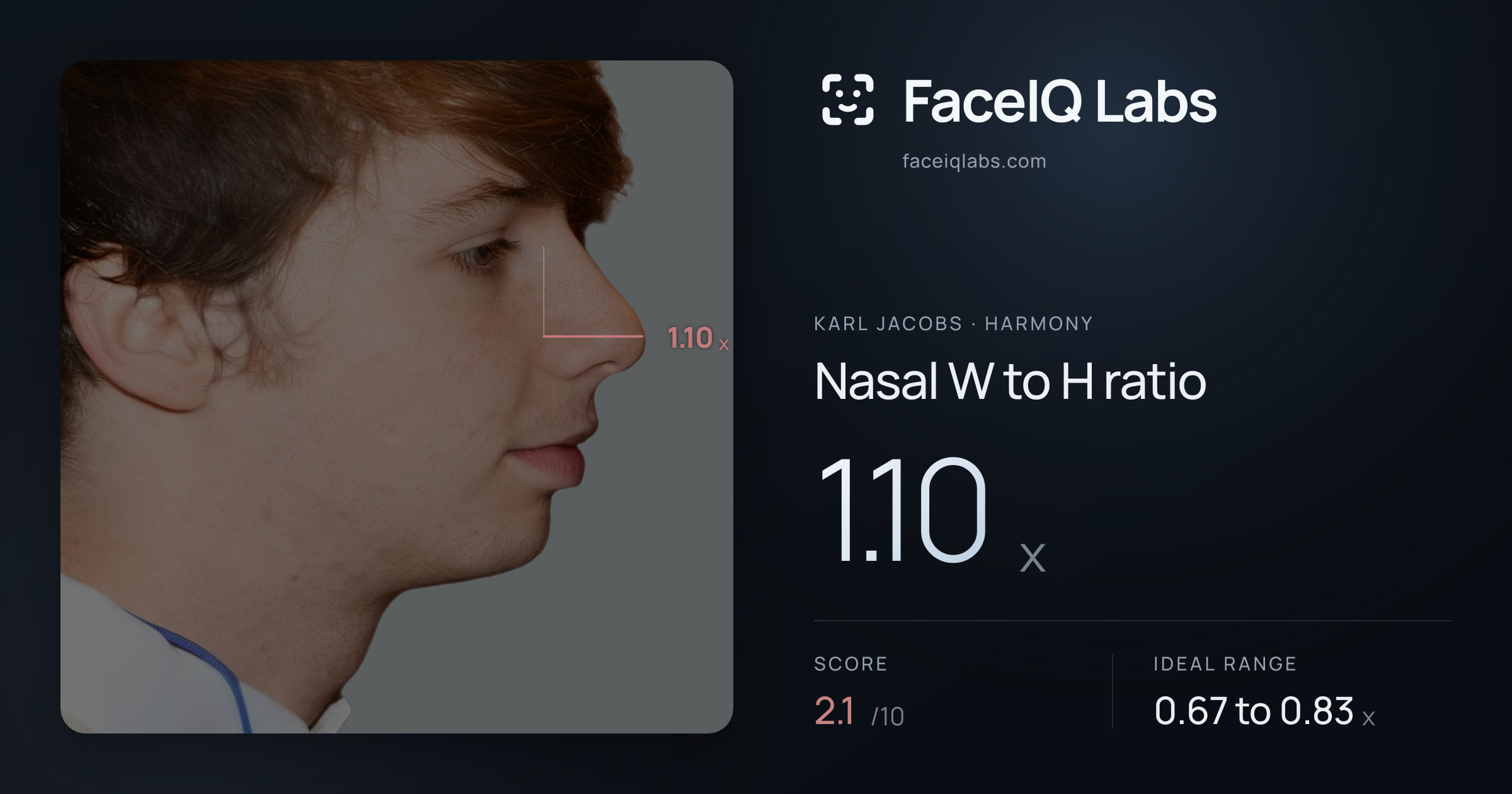 Karl Jacobs Nasal W to H ratio: 1.10x, drawn on the photo