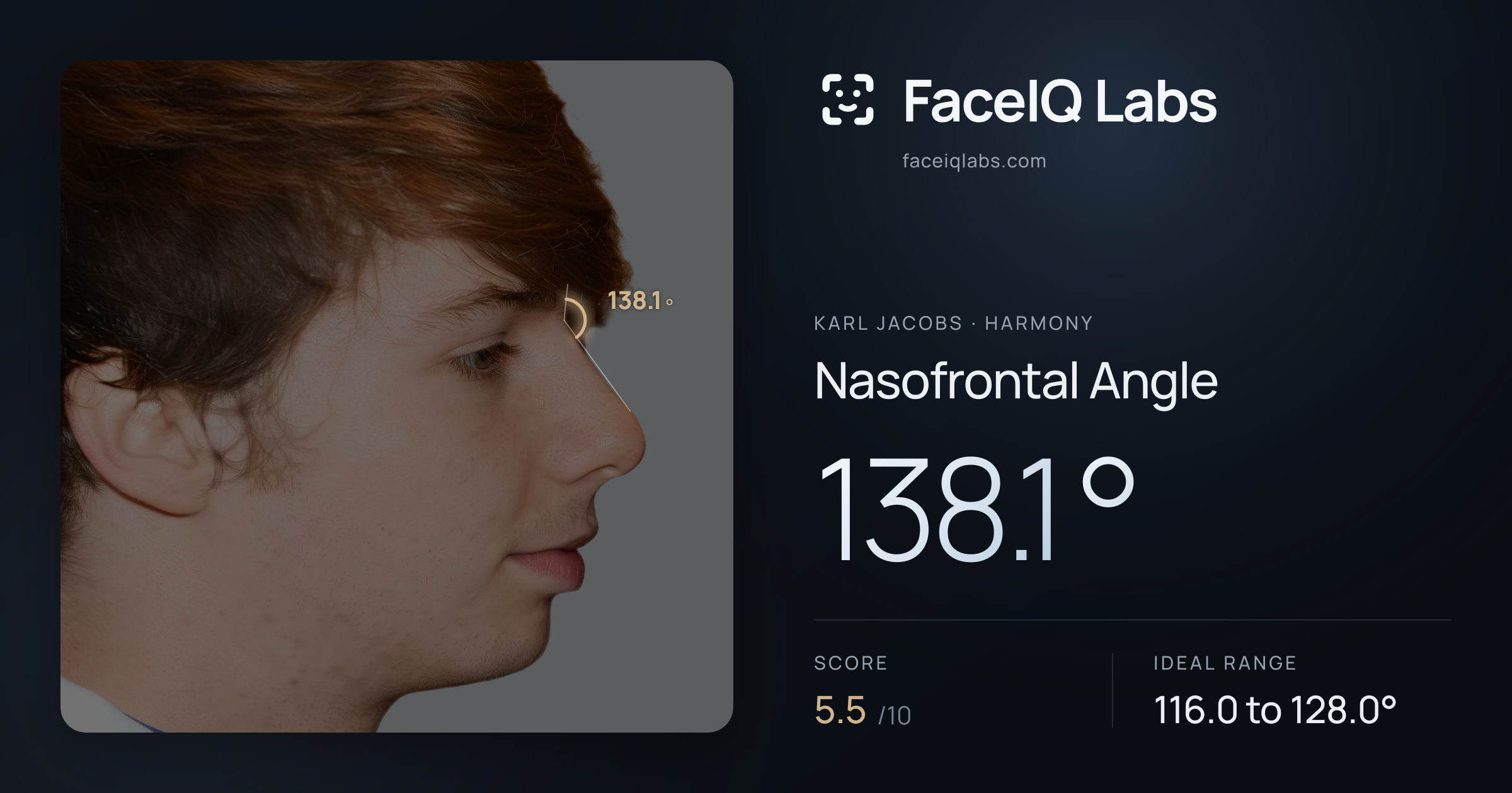 Karl Jacobs Nasofrontal Angle: 138.1°, drawn on the photo