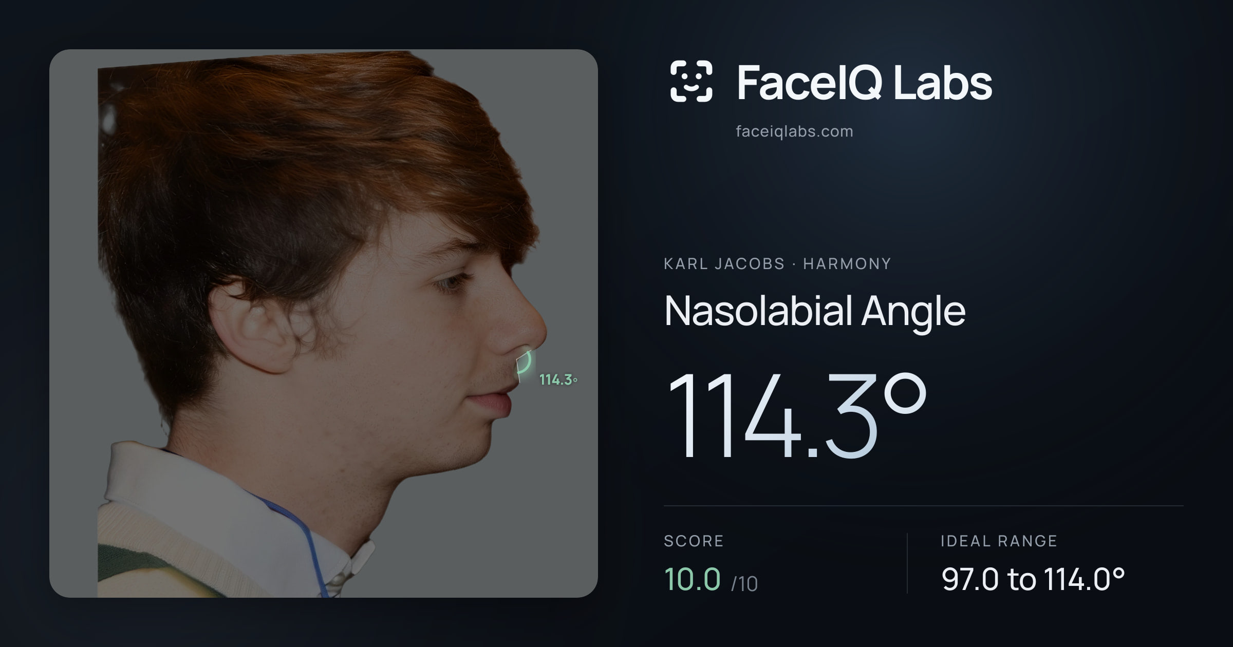 Karl Jacobs Nasolabial Angle: 114.3°, drawn on the photo