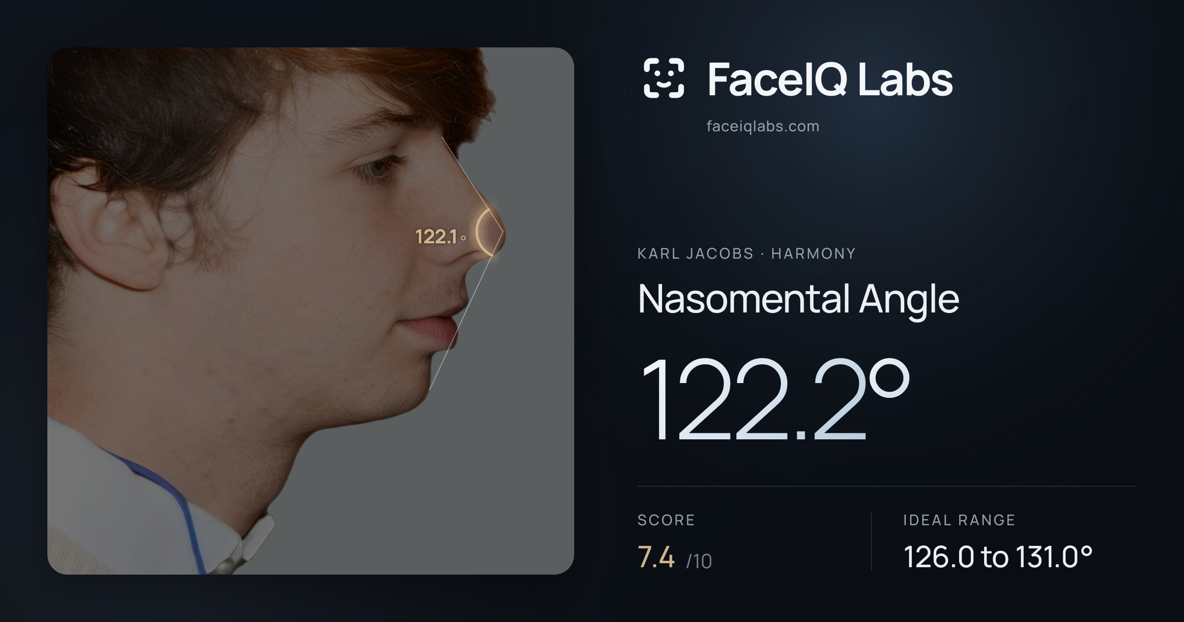 Karl Jacobs Nasomental Angle: 122.2°, drawn on the photo