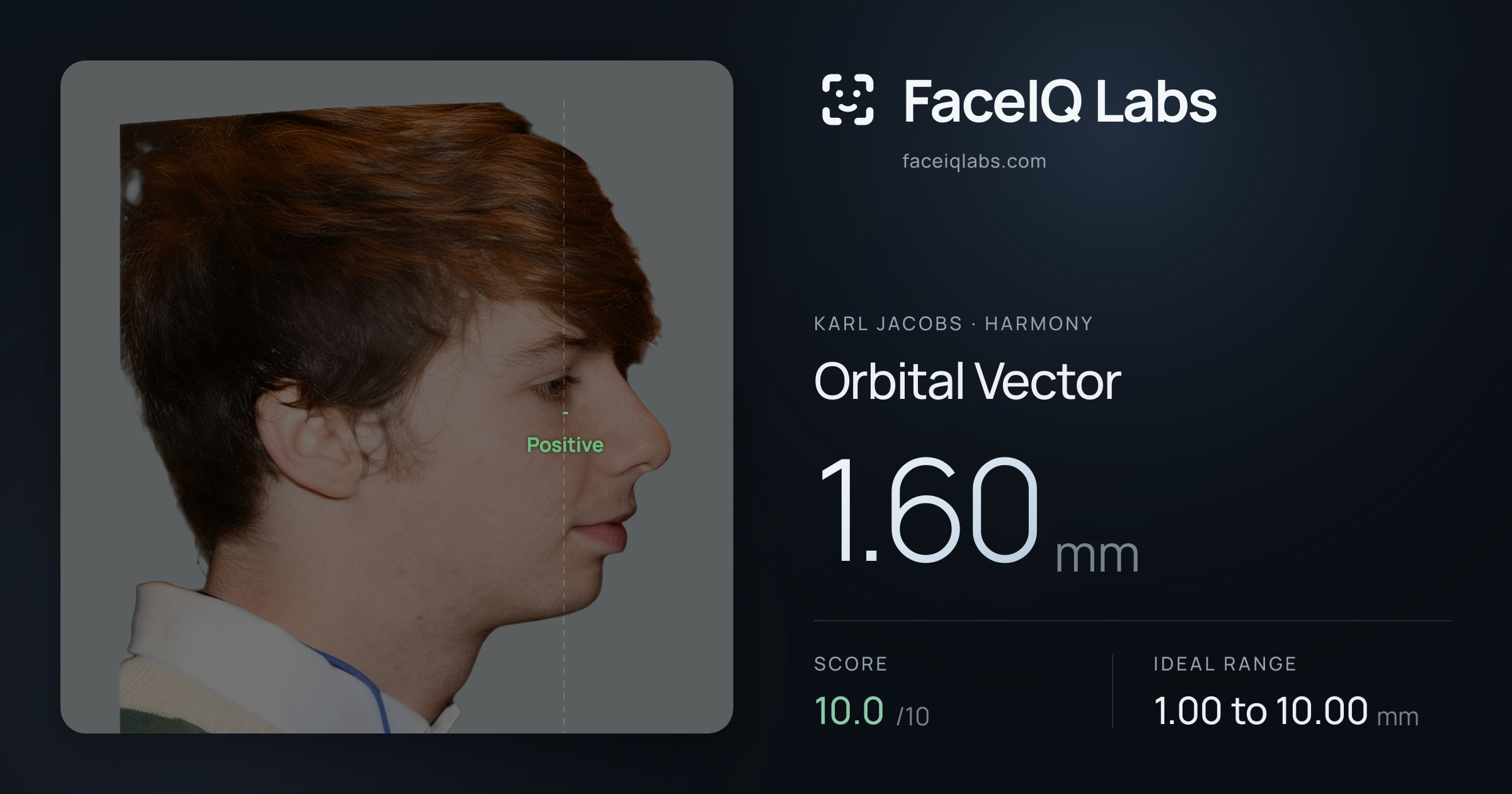 Karl Jacobs Orbital Vector: 1.60mm, drawn on the photo