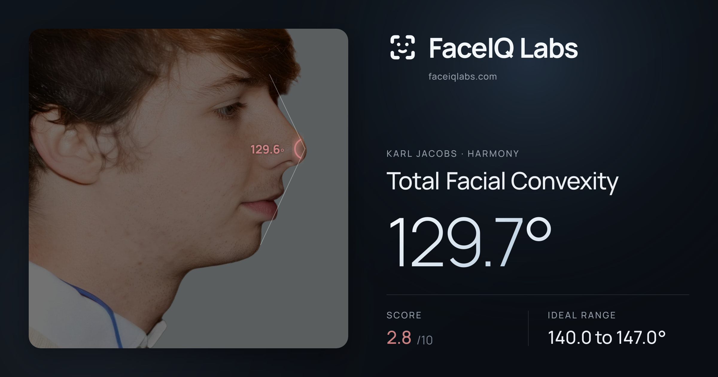 Karl Jacobs Total Facial Convexity: 129.7°, drawn on the photo