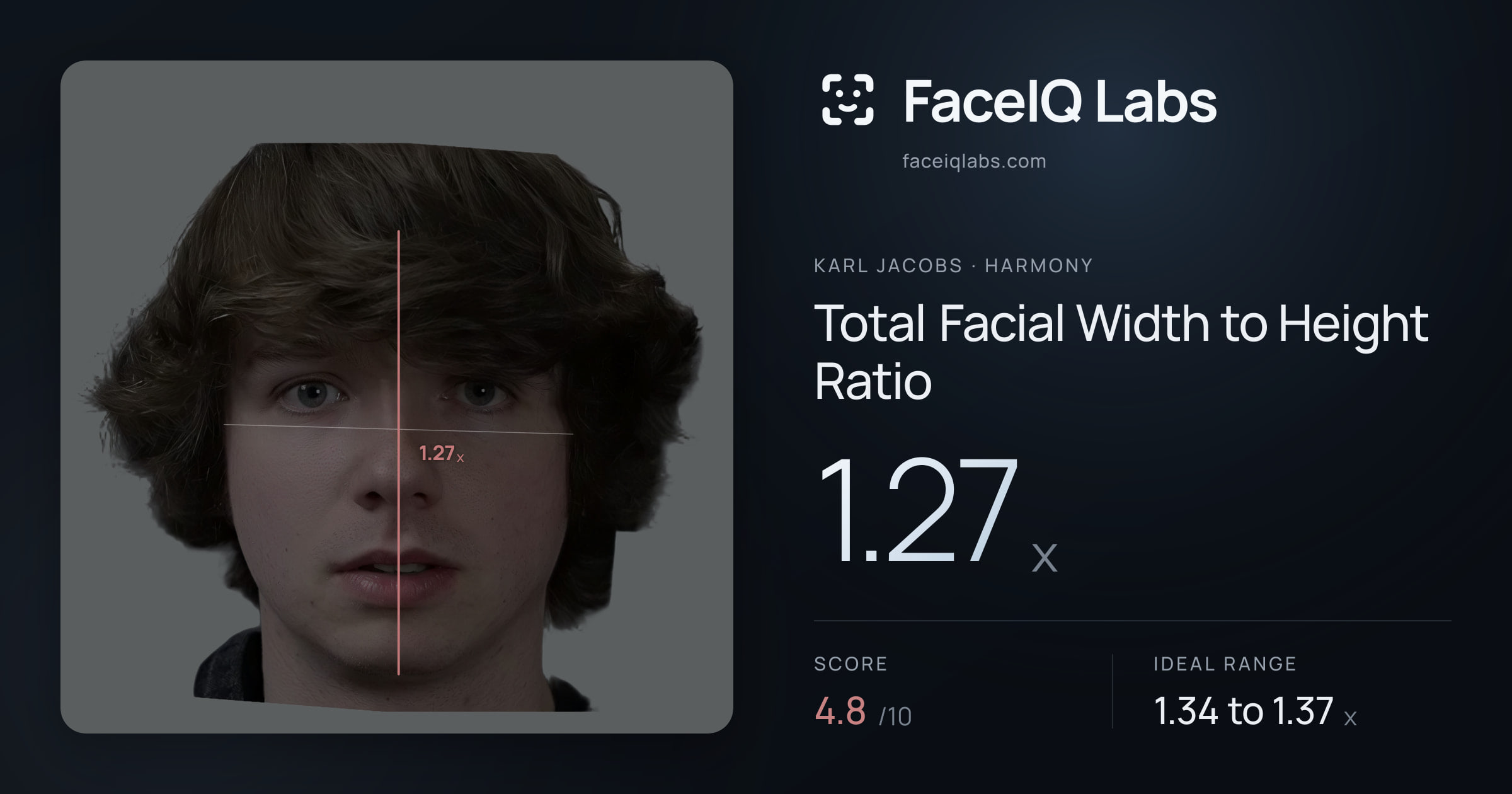 Karl Jacobs Total Facial Width to Height Ratio: 1.27x, drawn on the photo