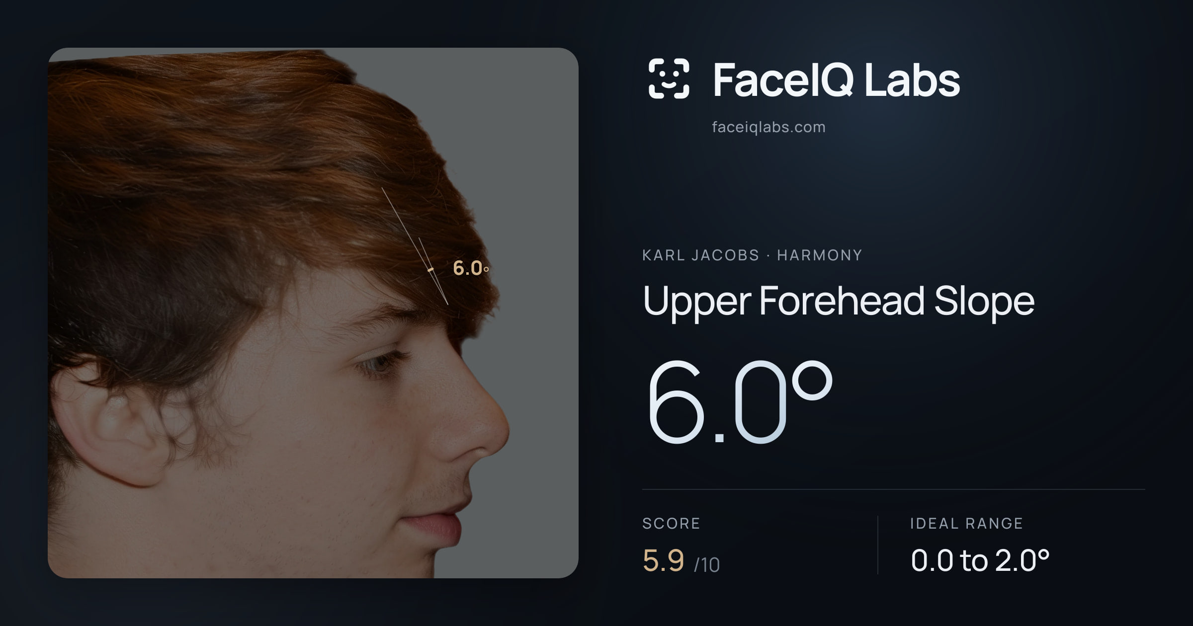 Karl Jacobs Upper Forehead Slope: 6.0°, drawn on the photo