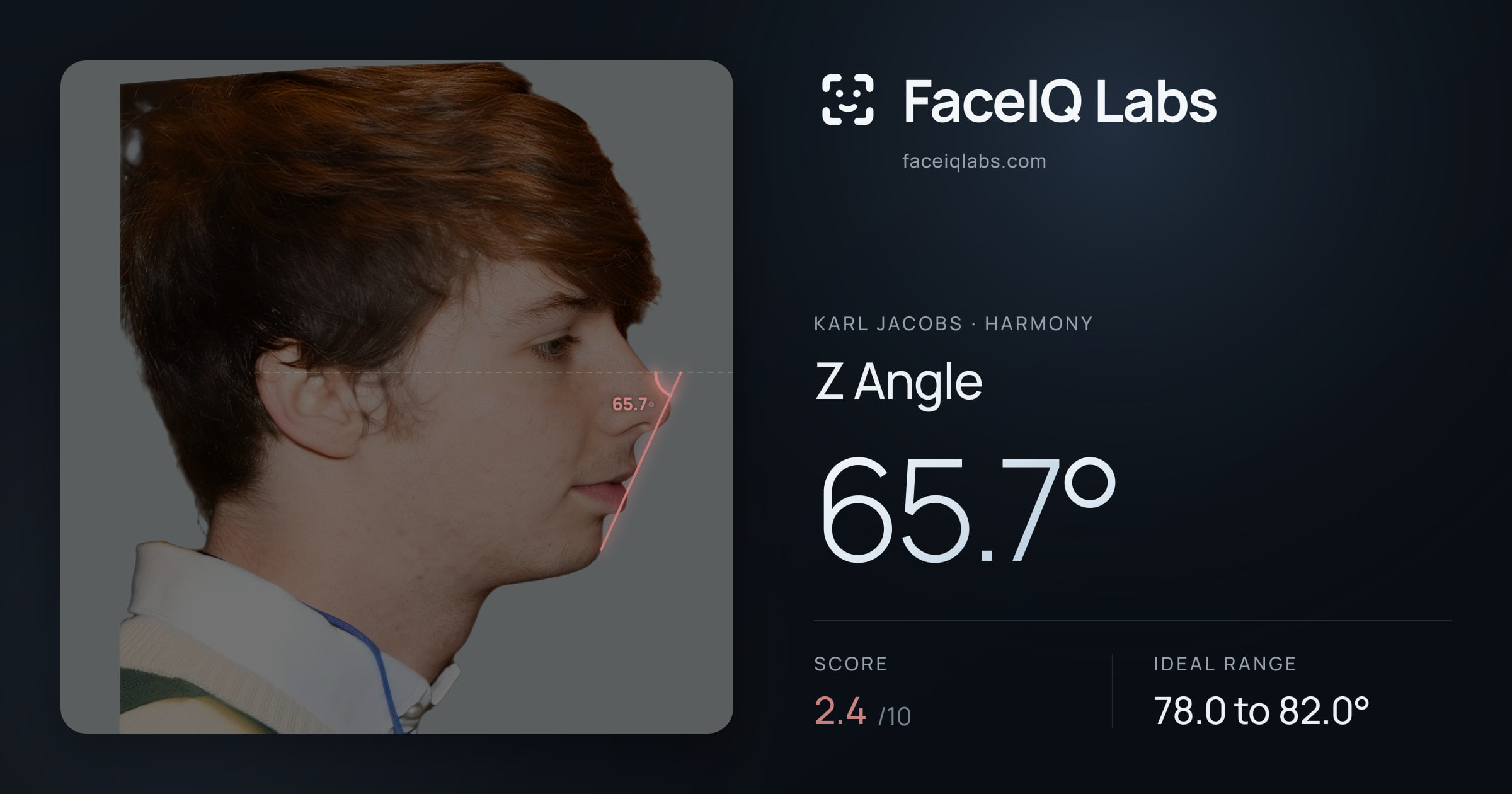 Karl Jacobs Z Angle: 65.7°, drawn on the photo