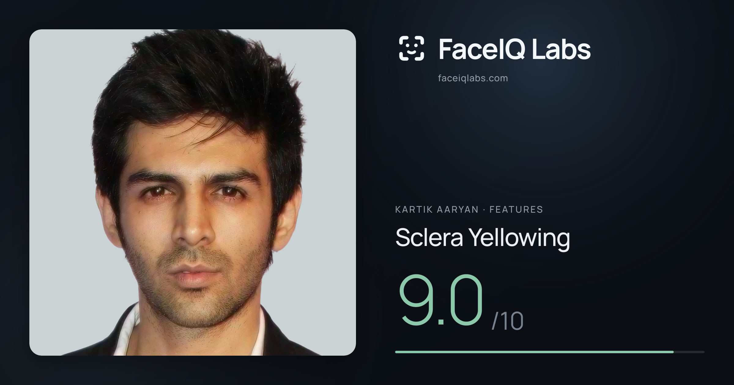 Kartik aaryan Sclera Yellowing: 9.0/10, drawn on the photo