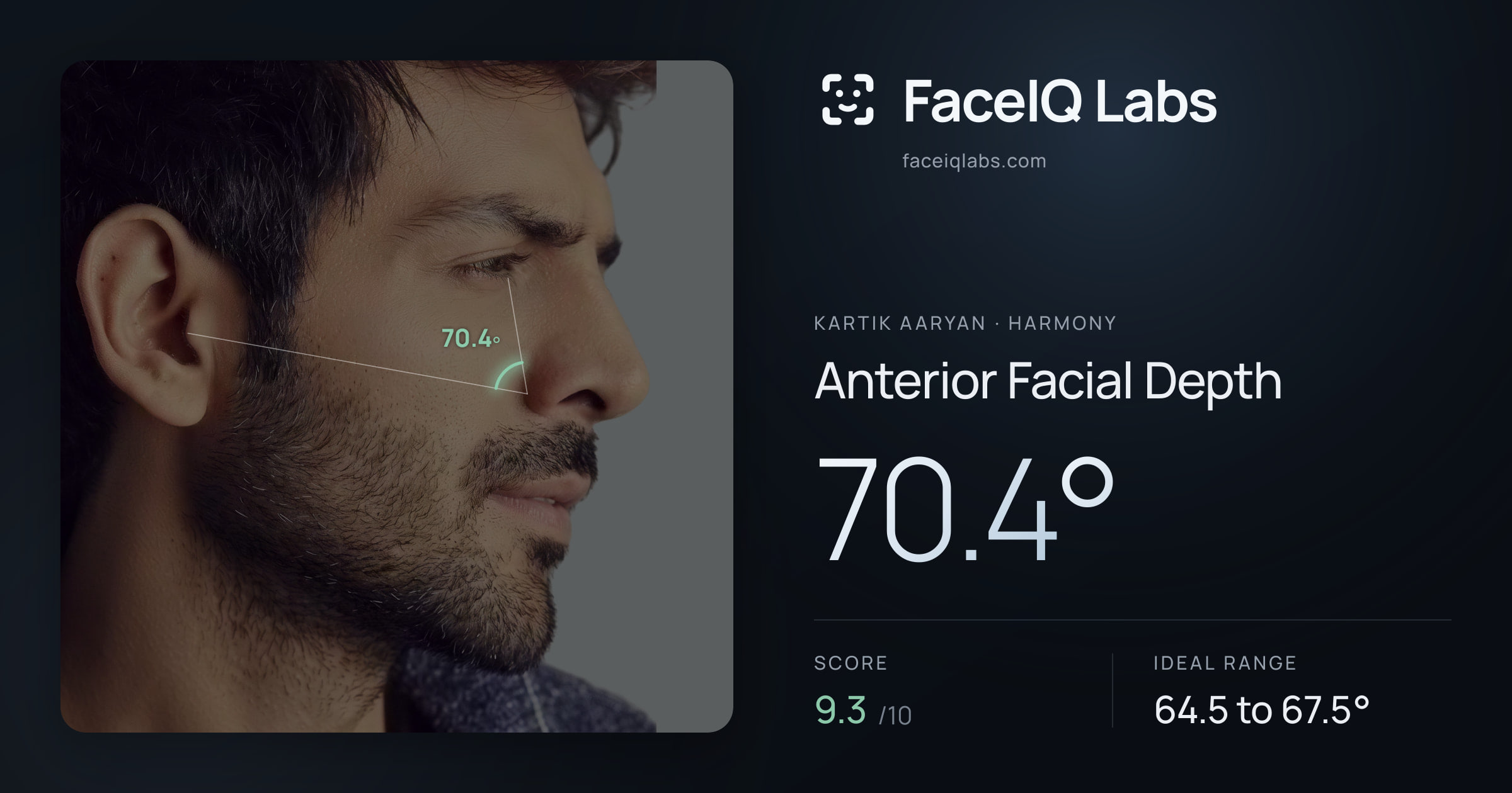 Kartik aaryan Anterior Facial Depth: 70.4°, drawn on the photo