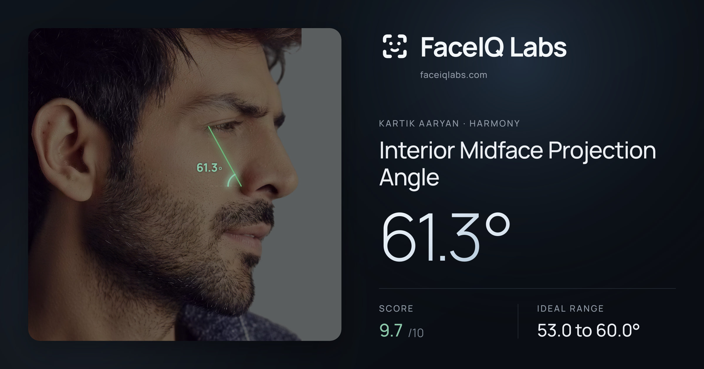 Kartik aaryan Interior Midface Projection Angle: 61.3°, drawn on the photo