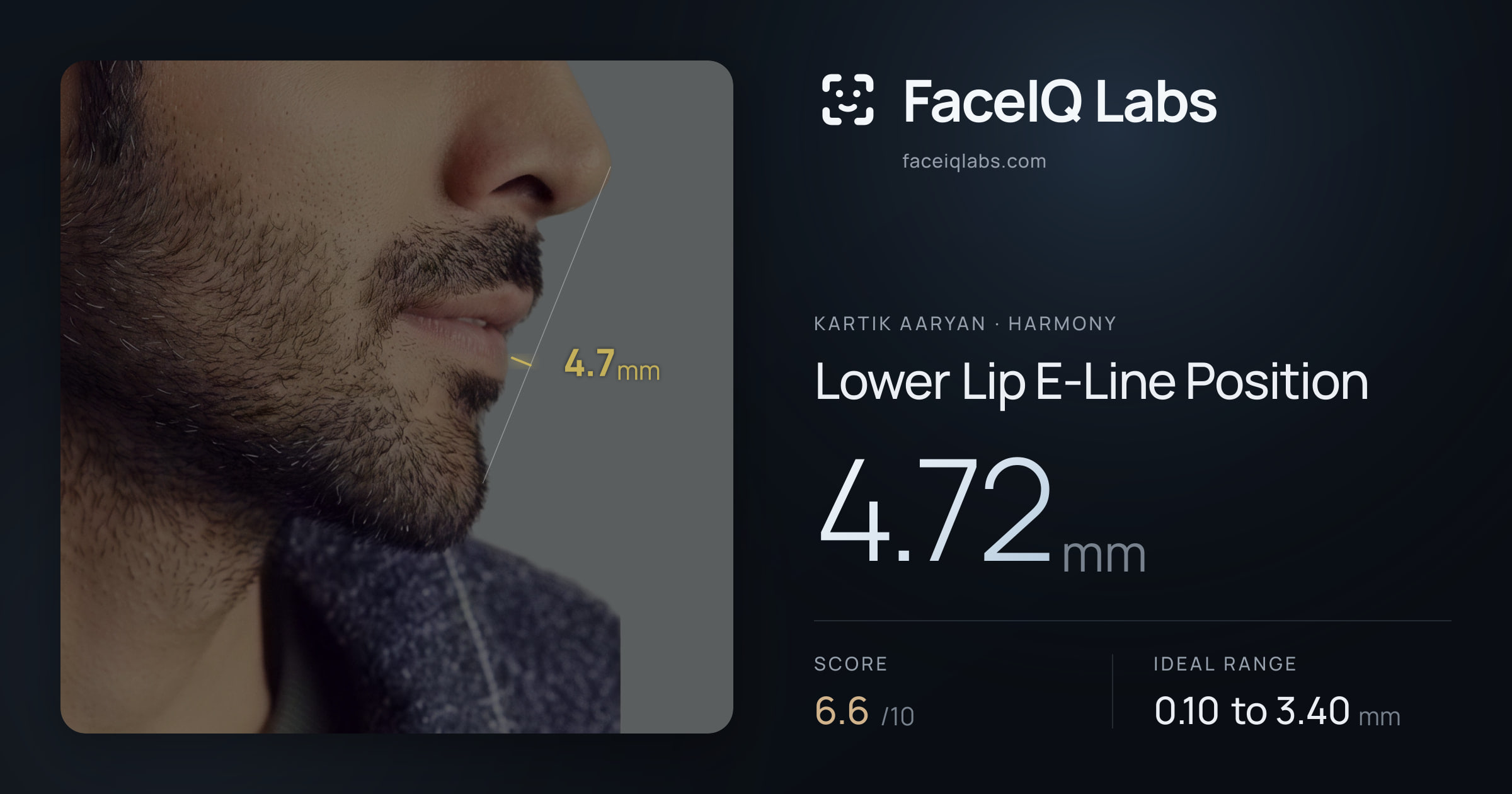 Kartik aaryan Lower Lip E-Line Position: 4.72mm, drawn on the photo