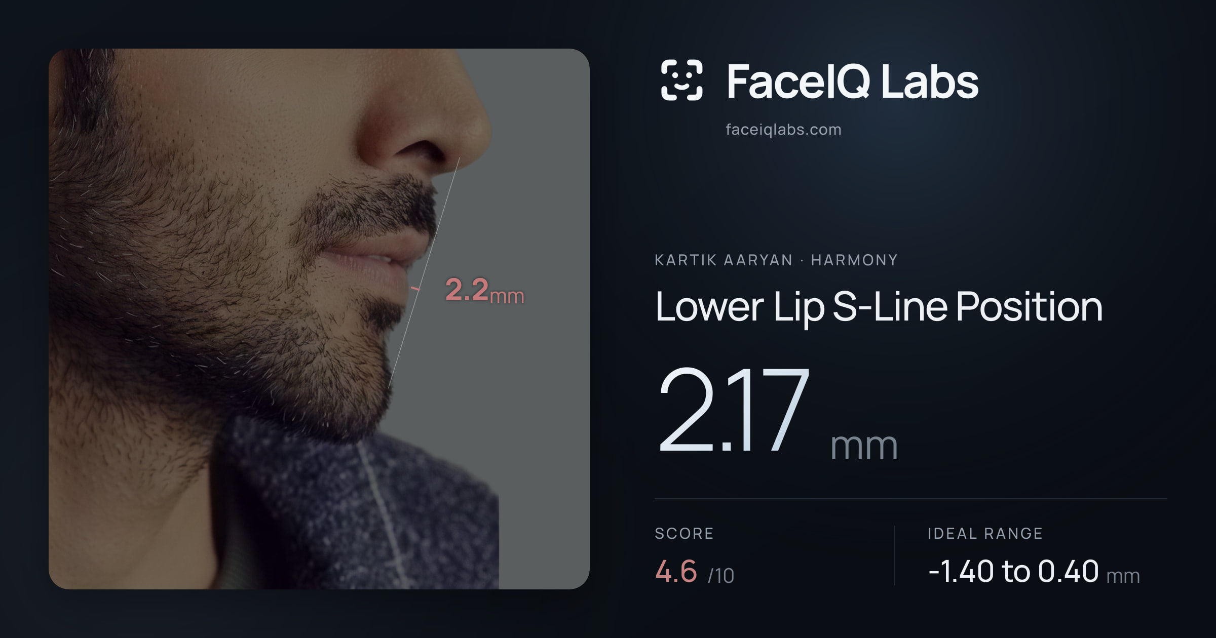 Kartik aaryan Lower Lip S-Line Position: 2.17mm, drawn on the photo