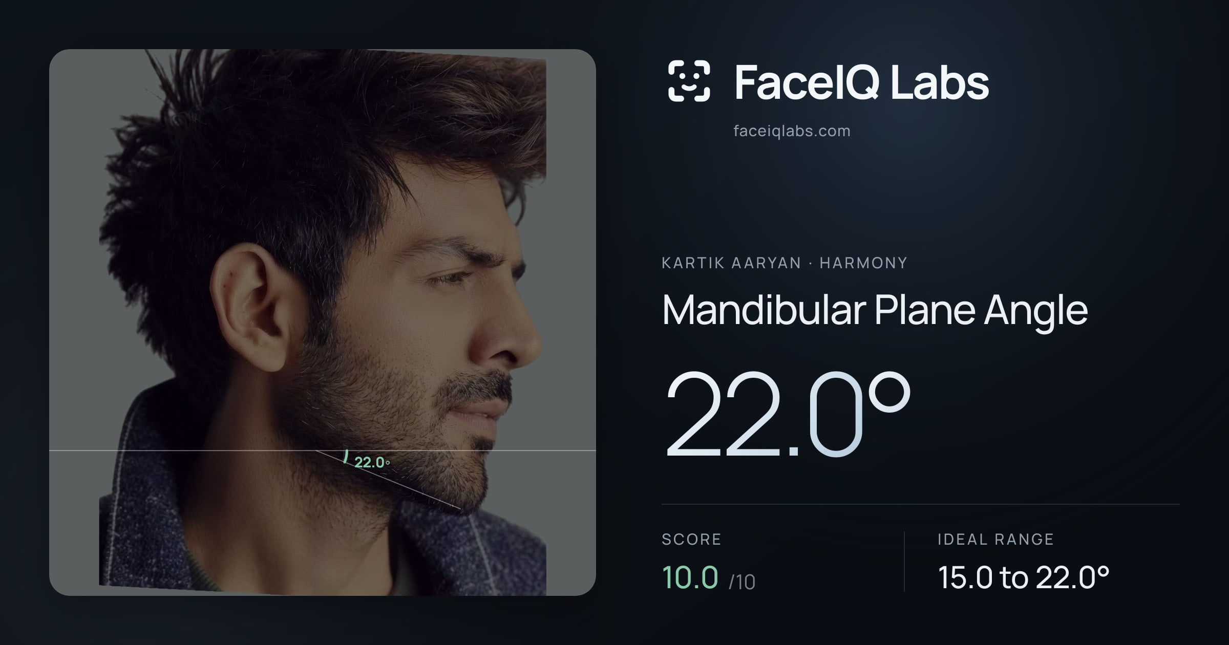 Kartik aaryan Mandibular Plane Angle: 22.0°, drawn on the photo