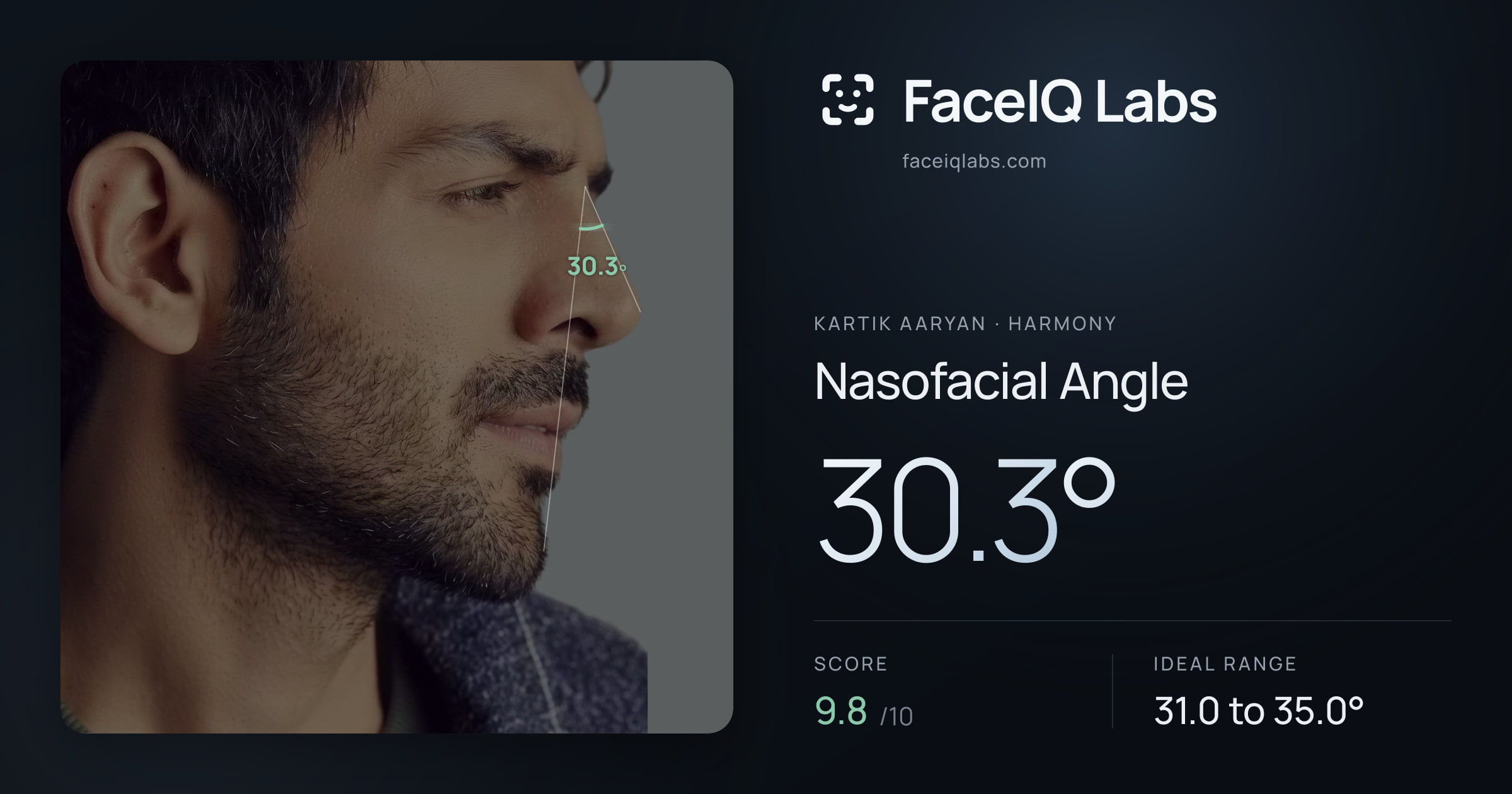 Kartik aaryan Nasofacial Angle: 30.3°, drawn on the photo