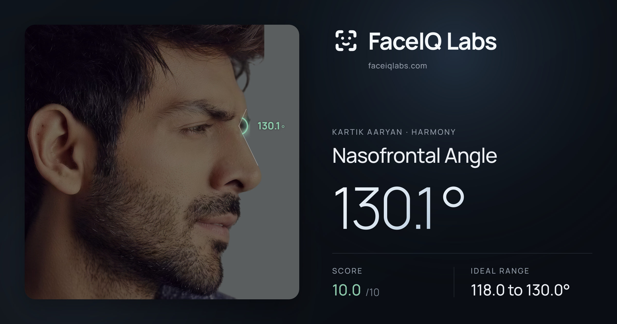 Kartik aaryan Nasofrontal Angle: 130.1°, drawn on the photo