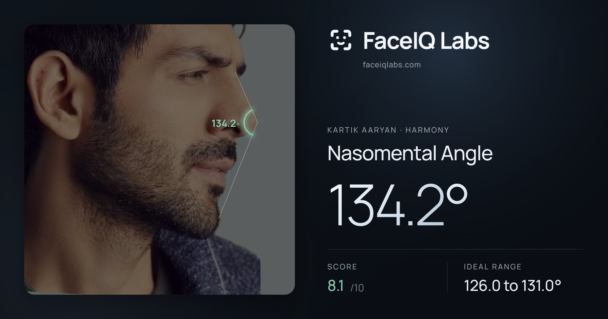 Kartik aaryan Nasomental Angle: 134.2°, drawn on the photo