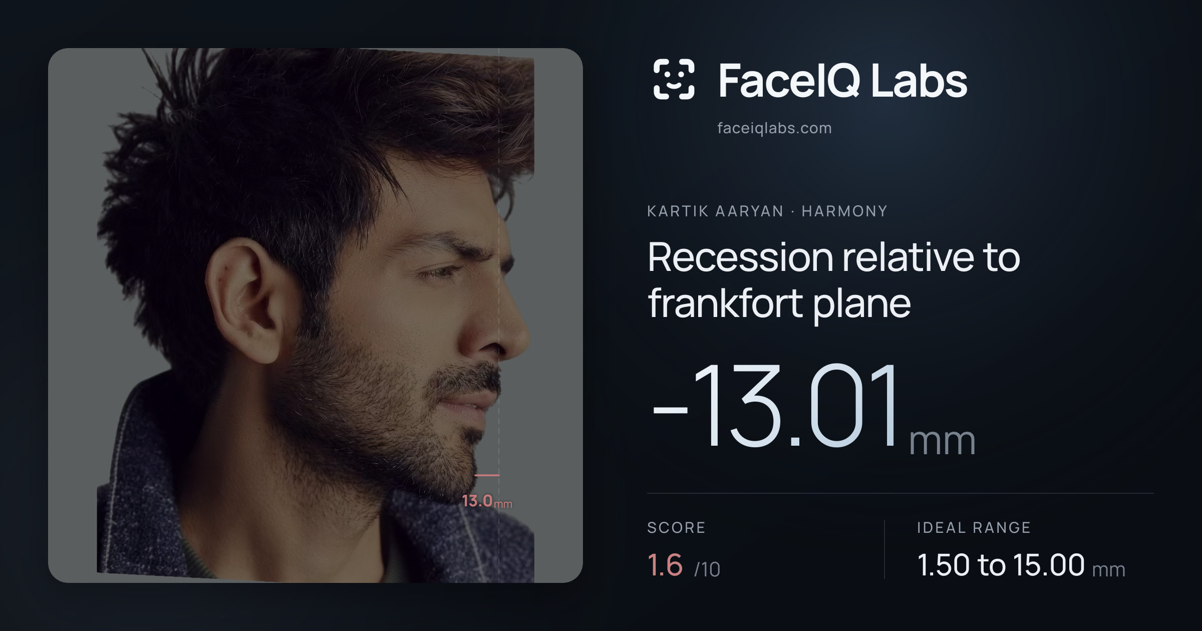 Kartik aaryan Recession relative to frankfort plane: -13.01mm, drawn on the photo