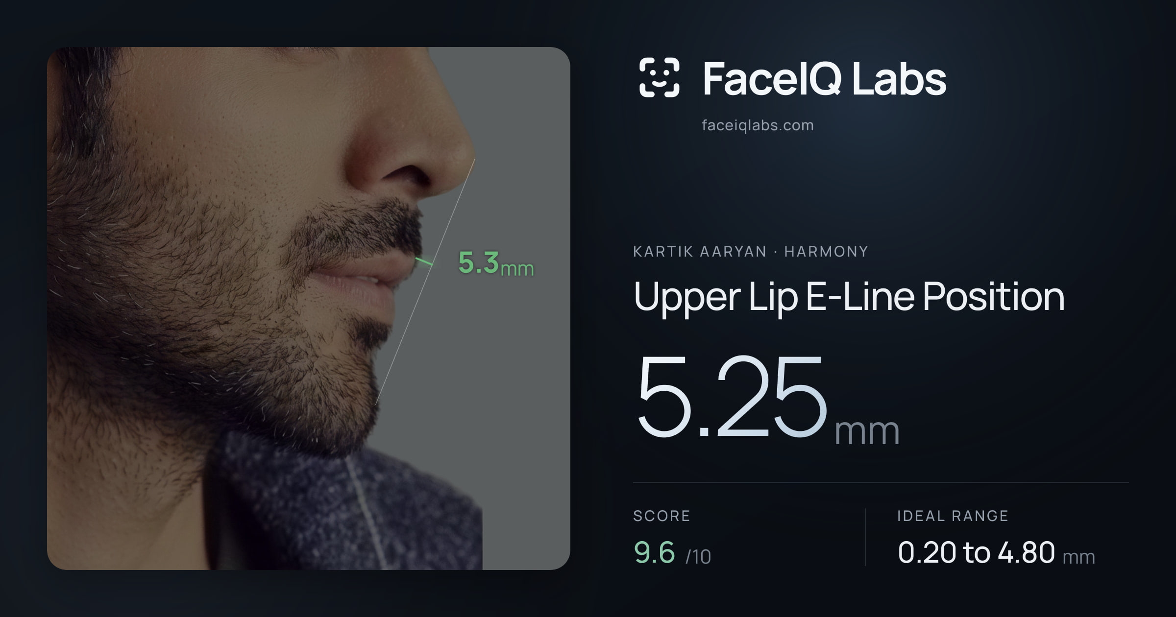 Kartik aaryan Upper Lip E-Line Position: 5.25mm, drawn on the photo