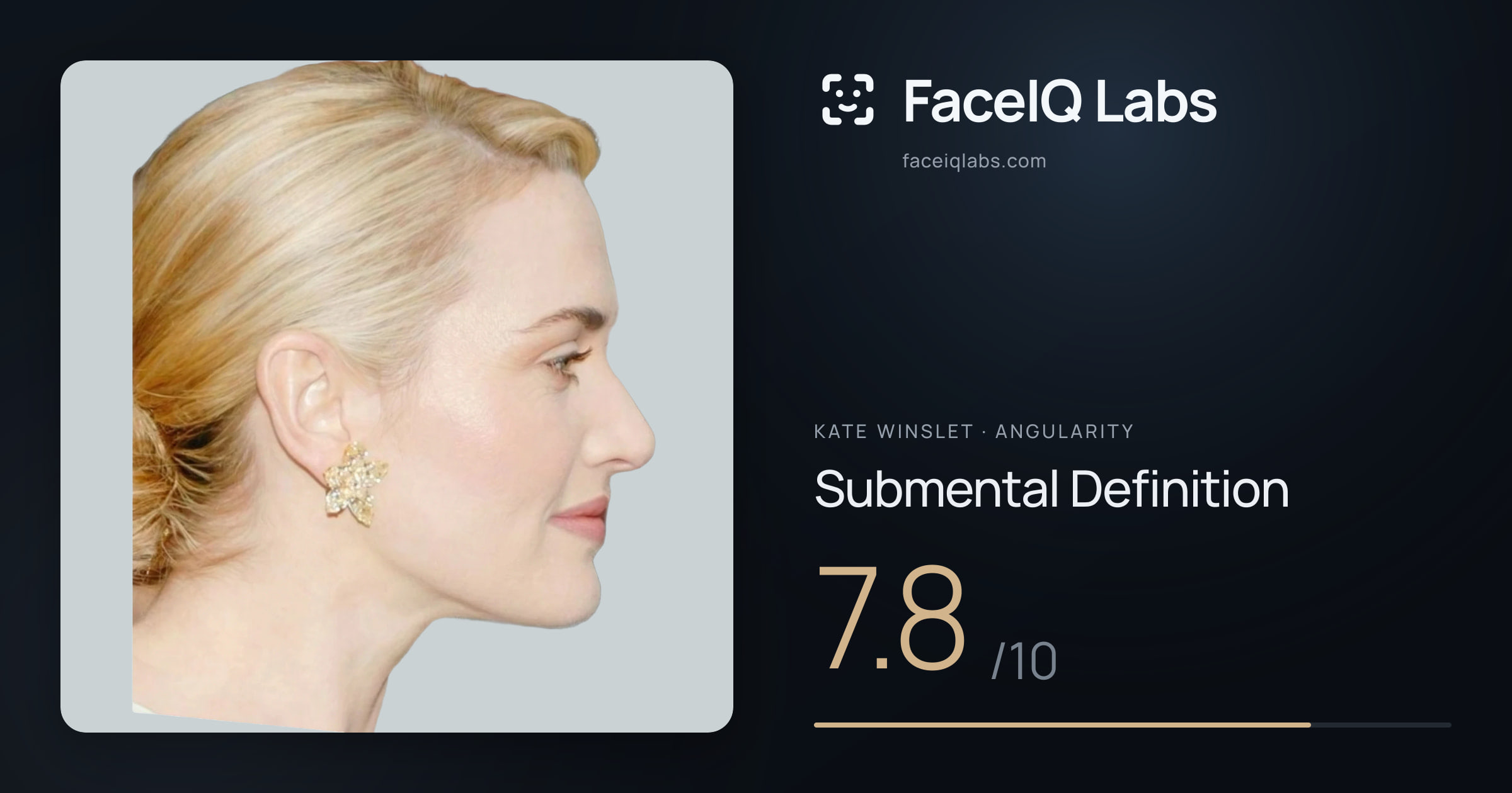 Kate Winslet Submental Definition: 7.8/10, drawn on the photo