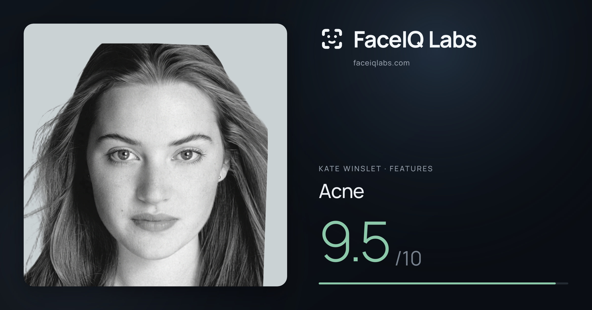 Kate Winslet Acne: 9.5/10, drawn on the photo