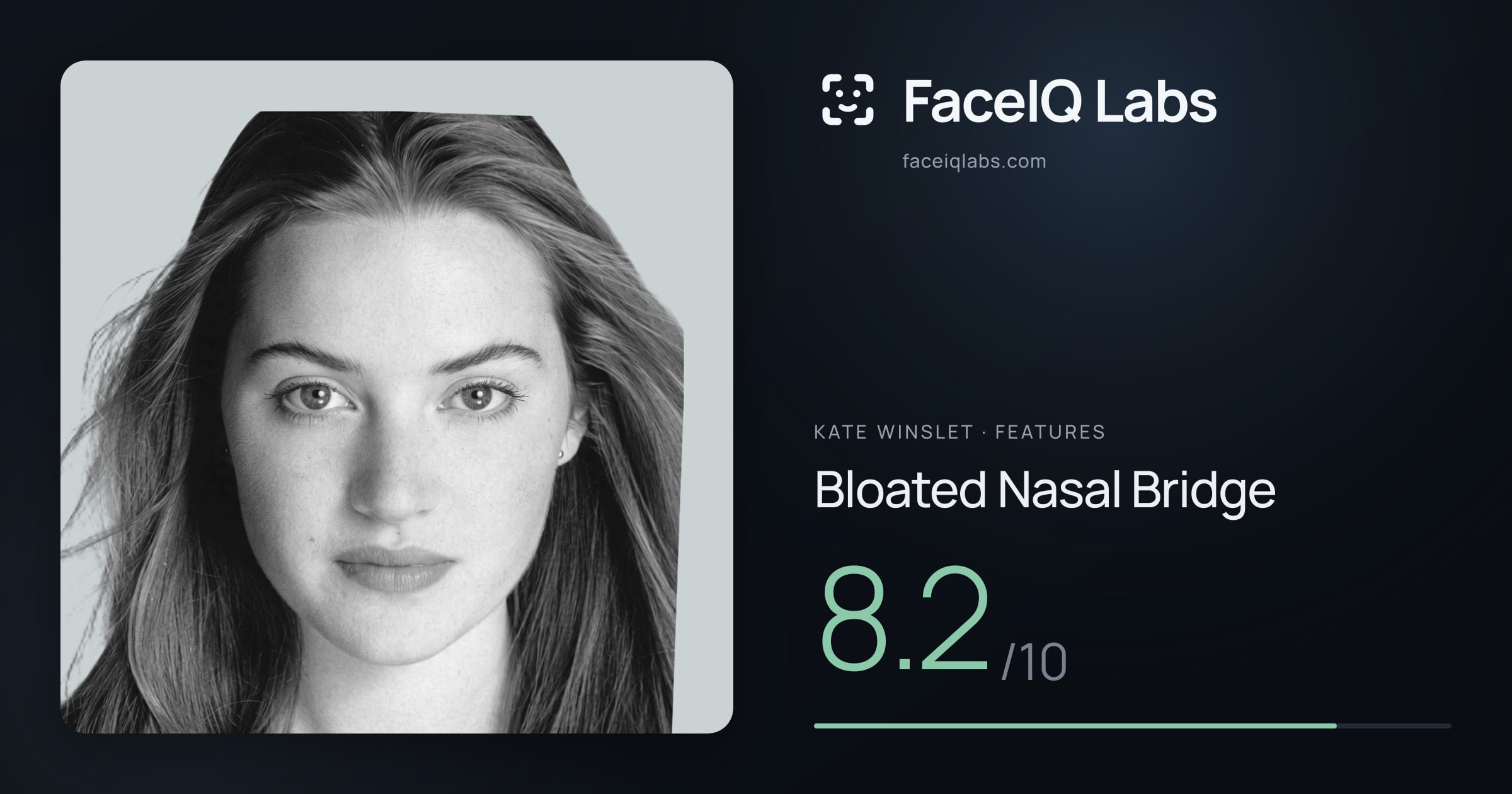 Kate Winslet Bloated Nasal Bridge: 8.2/10, drawn on the photo