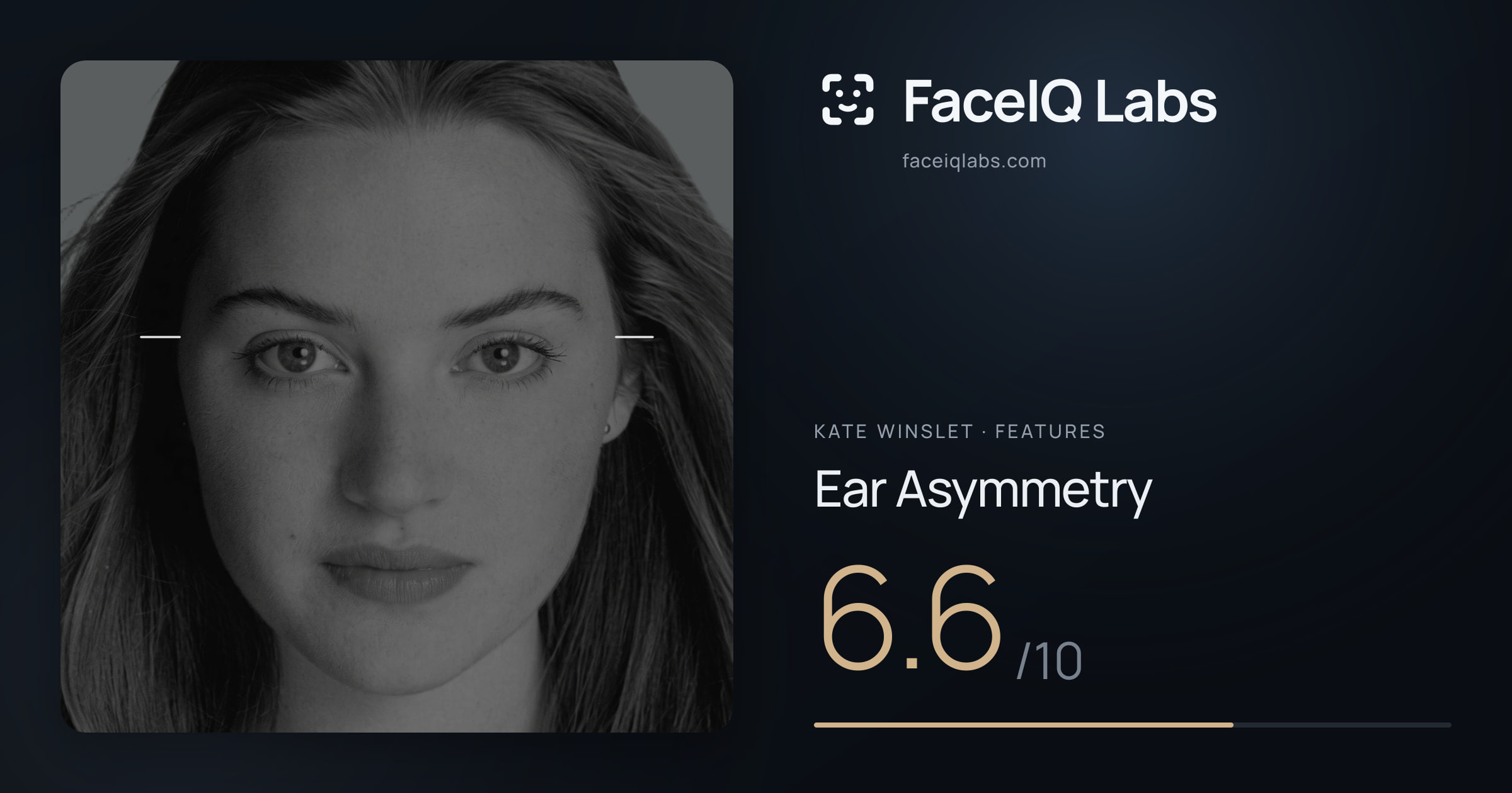 Kate Winslet Ear Asymmetry: 6.6/10, drawn on the photo