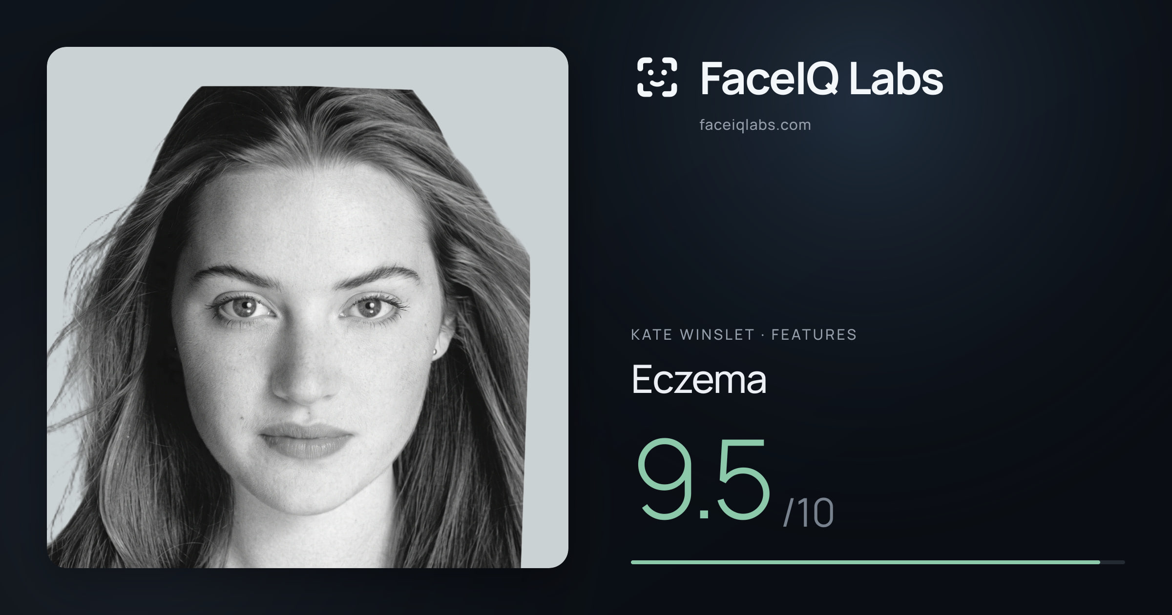 Kate Winslet Eczema: 9.5/10, drawn on the photo