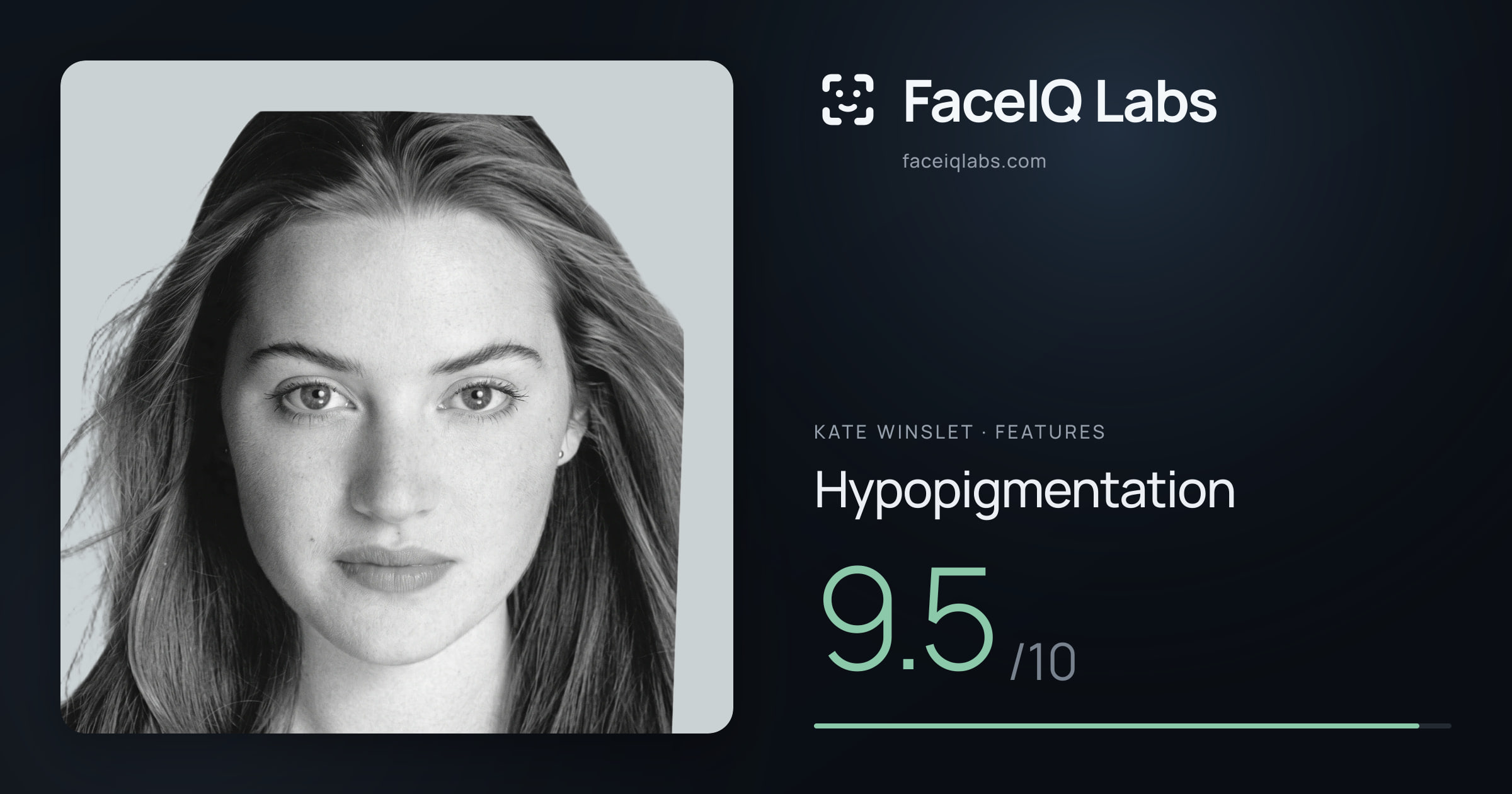 Kate Winslet Hypopigmentation: 9.5/10, drawn on the photo
