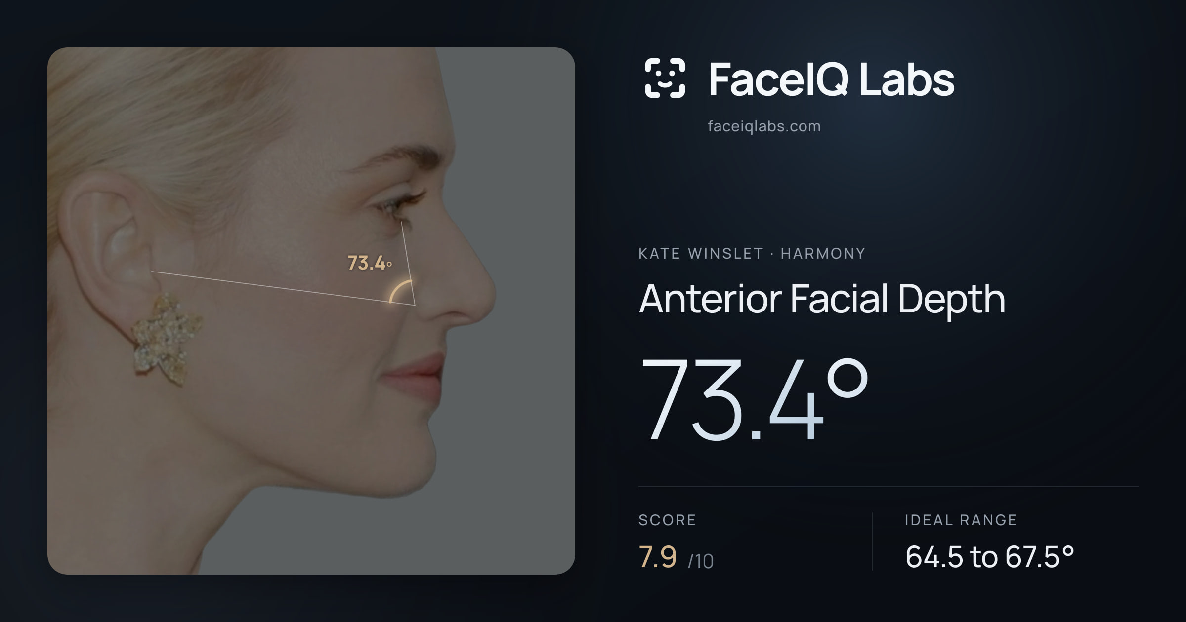 Kate Winslet Anterior Facial Depth: 73.4°, drawn on the photo