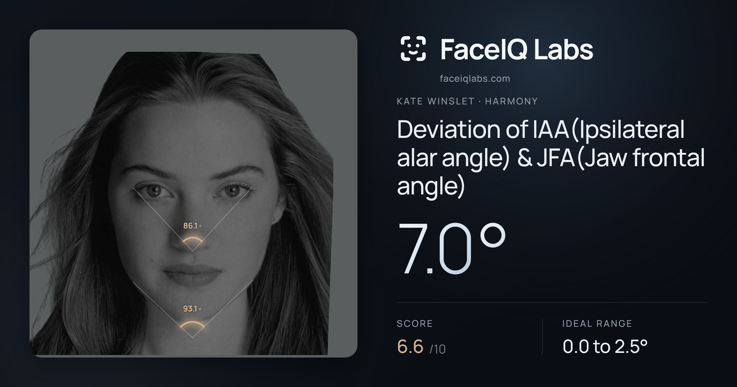 Kate Winslet Deviation of IAA(Ipsilateral alar angle) & JFA(Jaw frontal angle): 7.0°, drawn on the photo