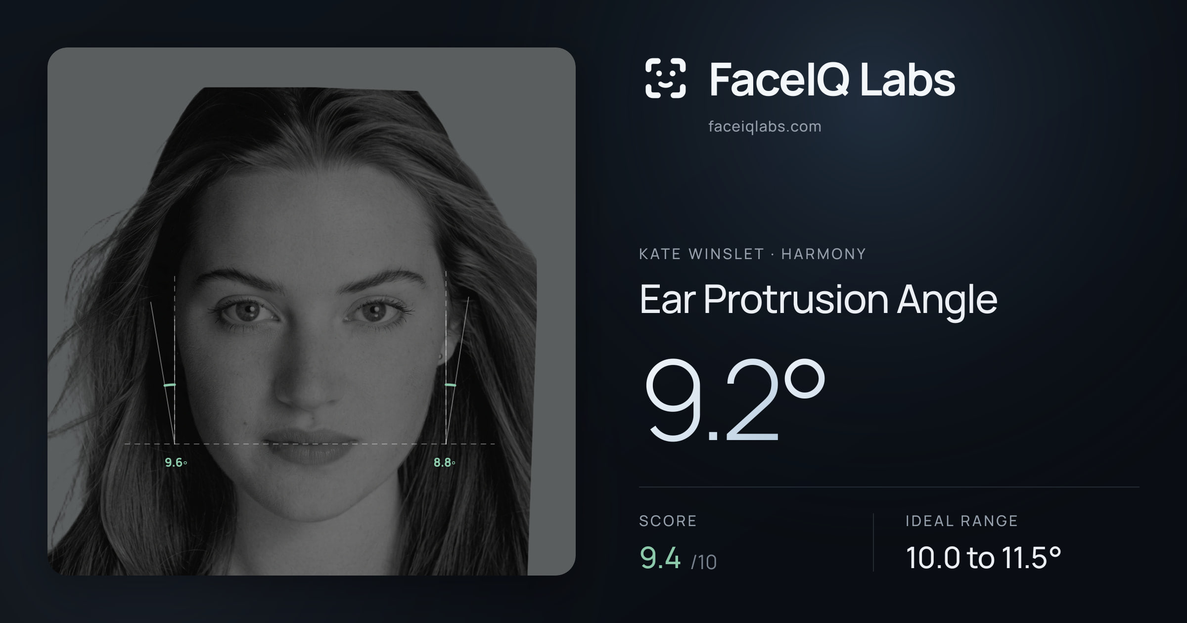 Kate Winslet Ear Protrusion Angle: 9.2°, drawn on the photo