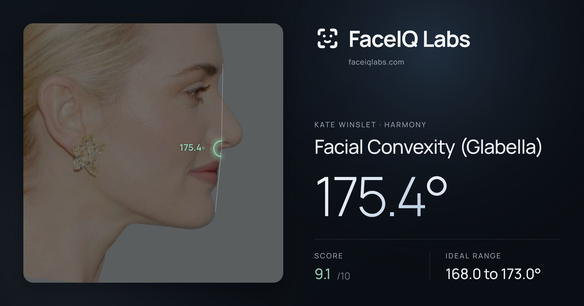 Kate Winslet Facial Convexity (Glabella): 175.4°, drawn on the photo