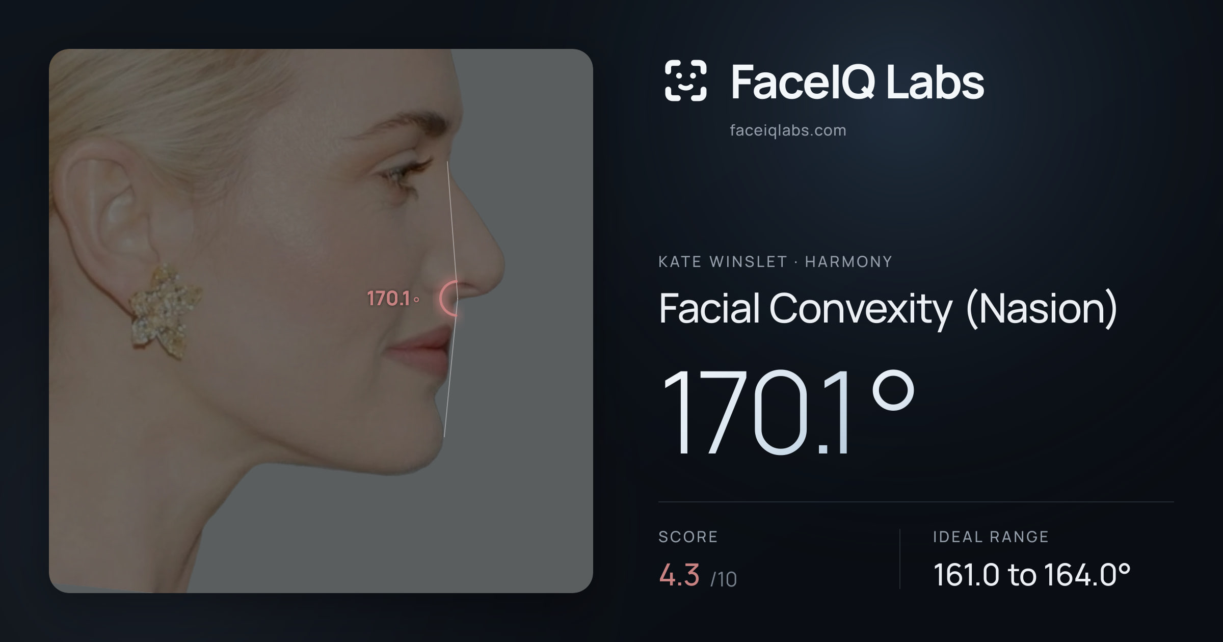 Kate Winslet Facial Convexity (Nasion): 170.1°, drawn on the photo