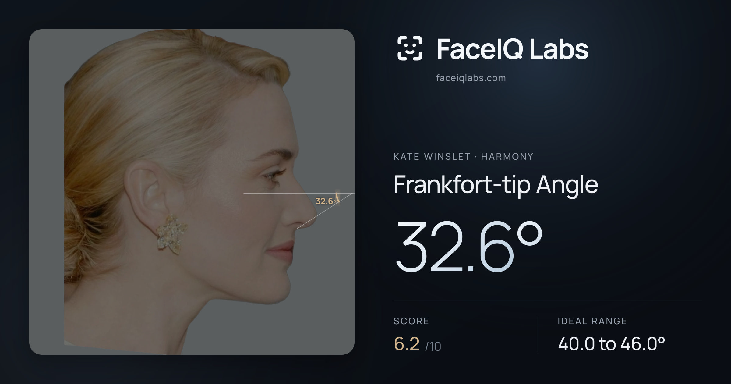 Kate Winslet Frankfort-tip Angle: 32.6°, drawn on the photo