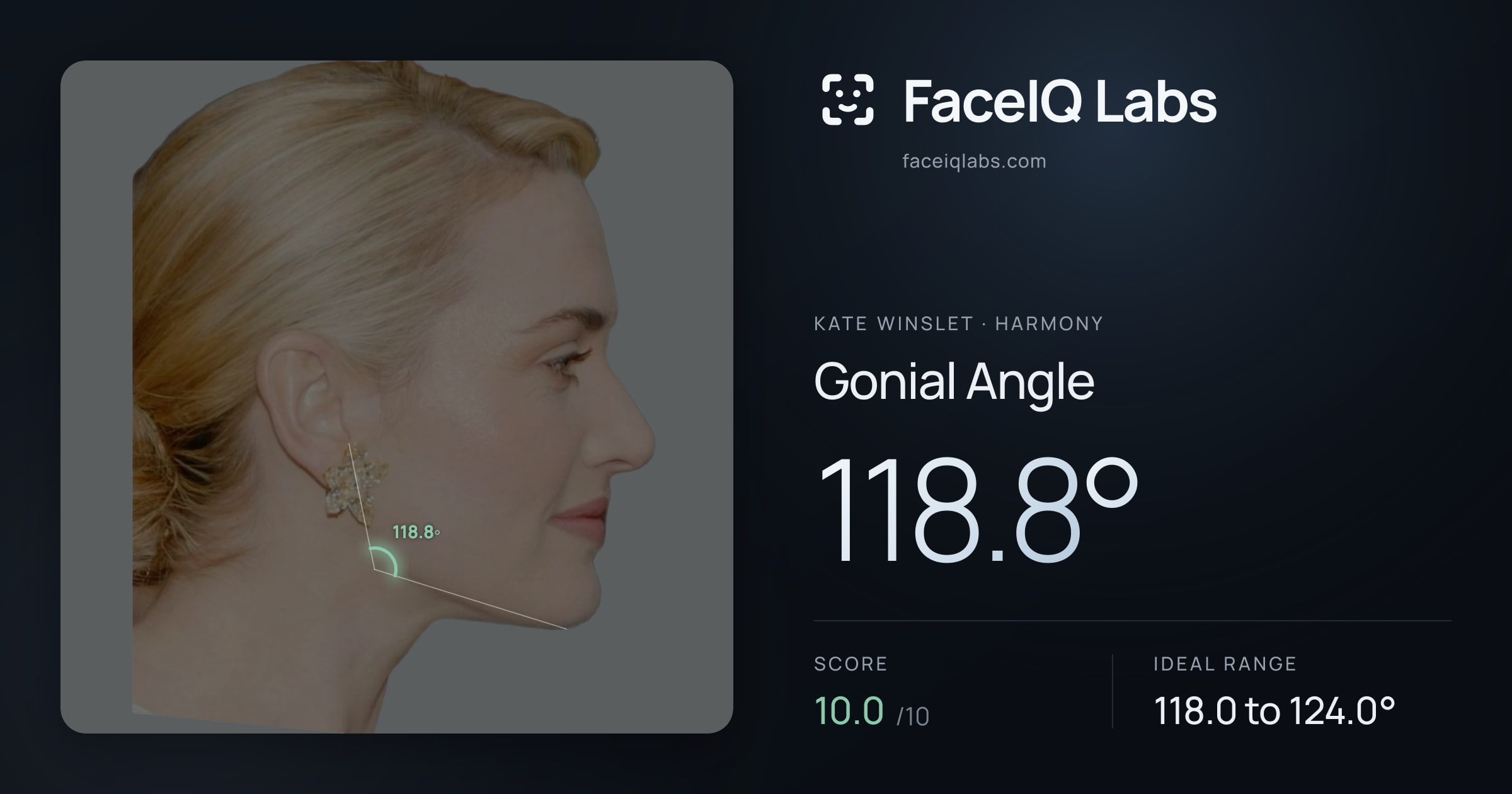 Kate Winslet Gonial Angle: 118.8°, drawn on the photo