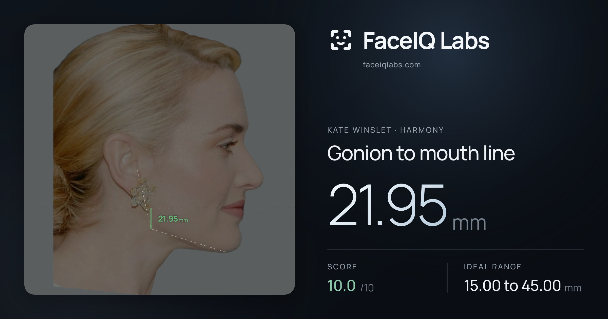 Kate Winslet Gonion to mouth line: 21.95mm, drawn on the photo