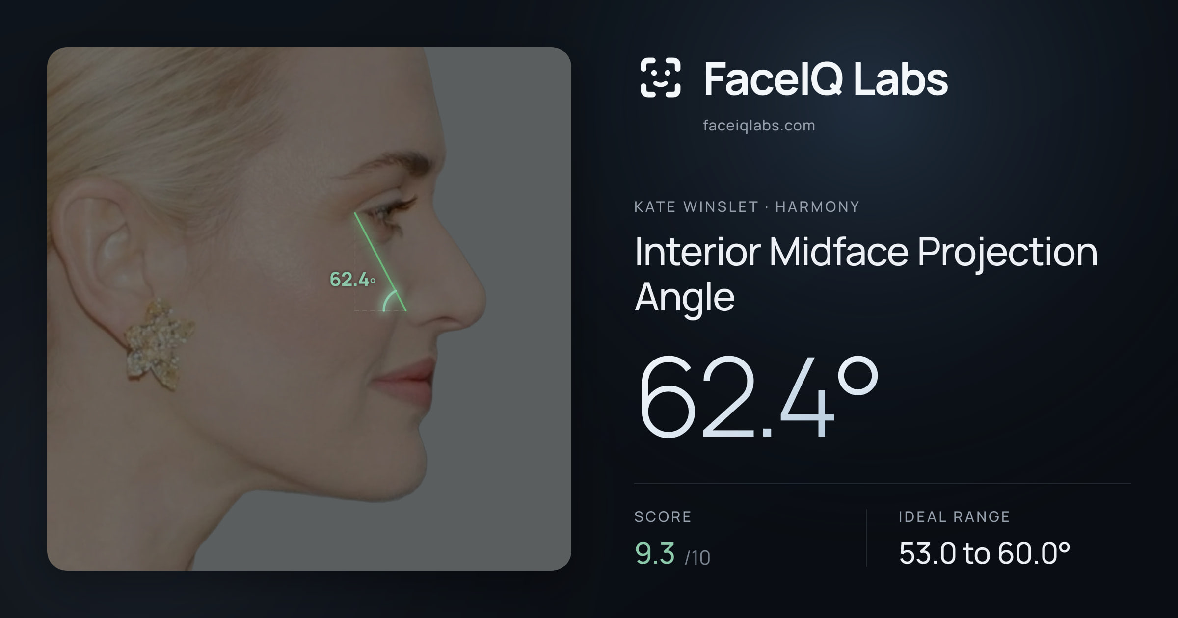 Kate Winslet Interior Midface Projection Angle: 62.4°, drawn on the photo