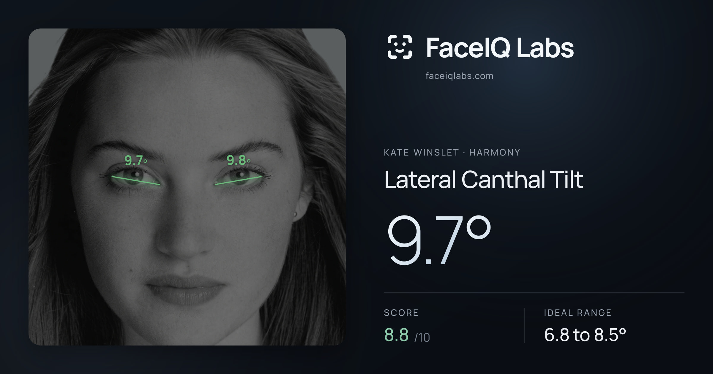 Kate Winslet Lateral Canthal Tilt: 9.7°, drawn on the photo