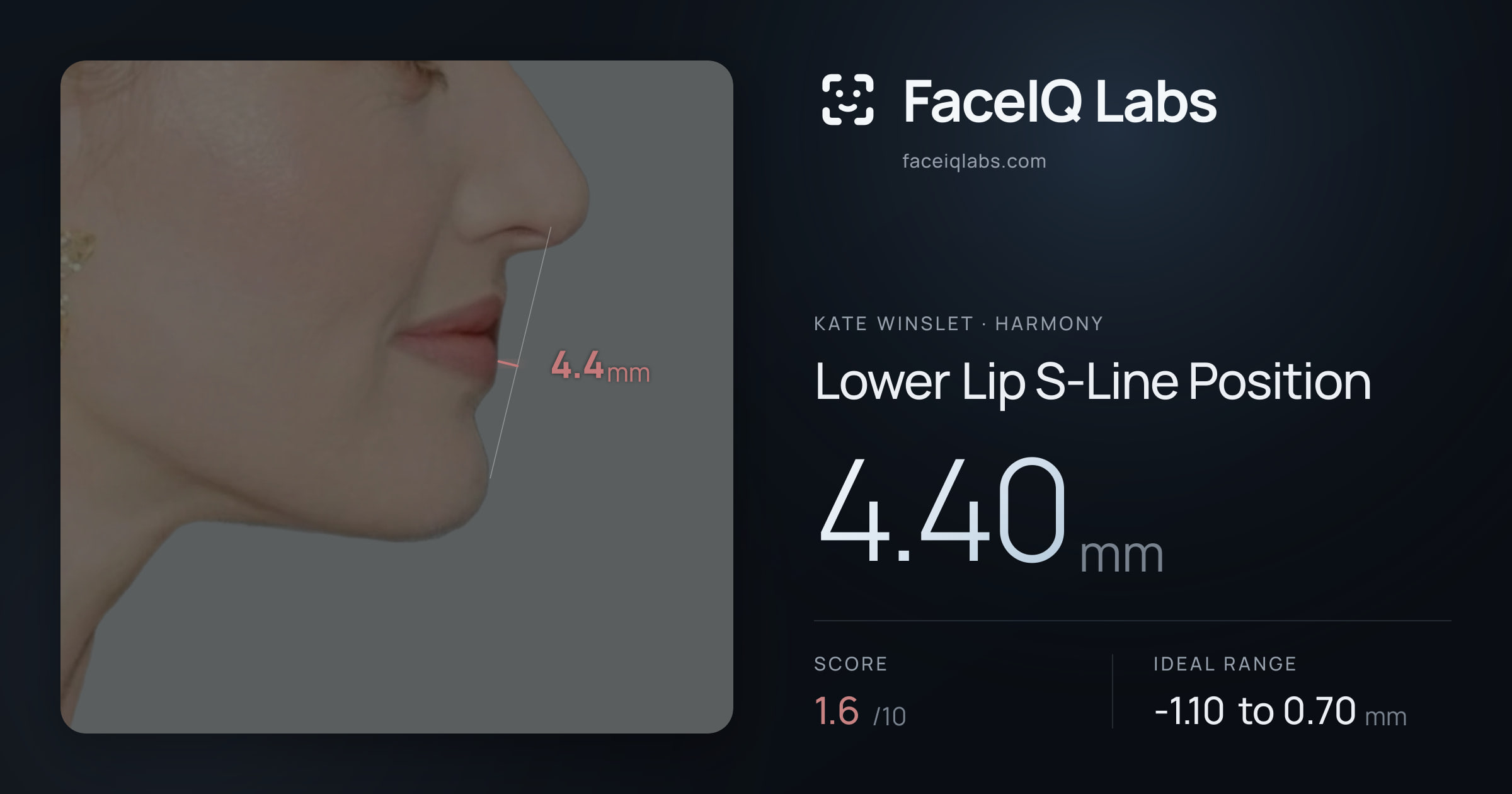 Kate Winslet Lower Lip S-Line Position: 4.40mm, drawn on the photo