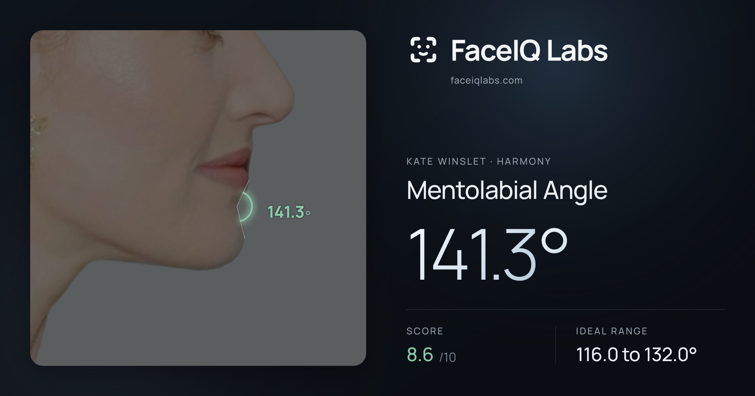 Kate Winslet Mentolabial Angle: 141.3°, drawn on the photo