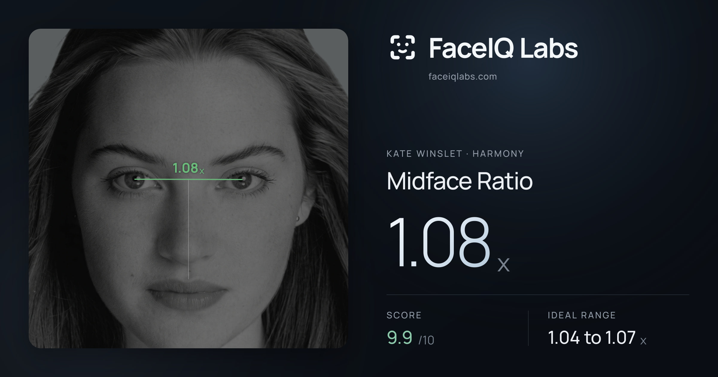 Kate Winslet Midface Ratio: 1.08x, drawn on the photo