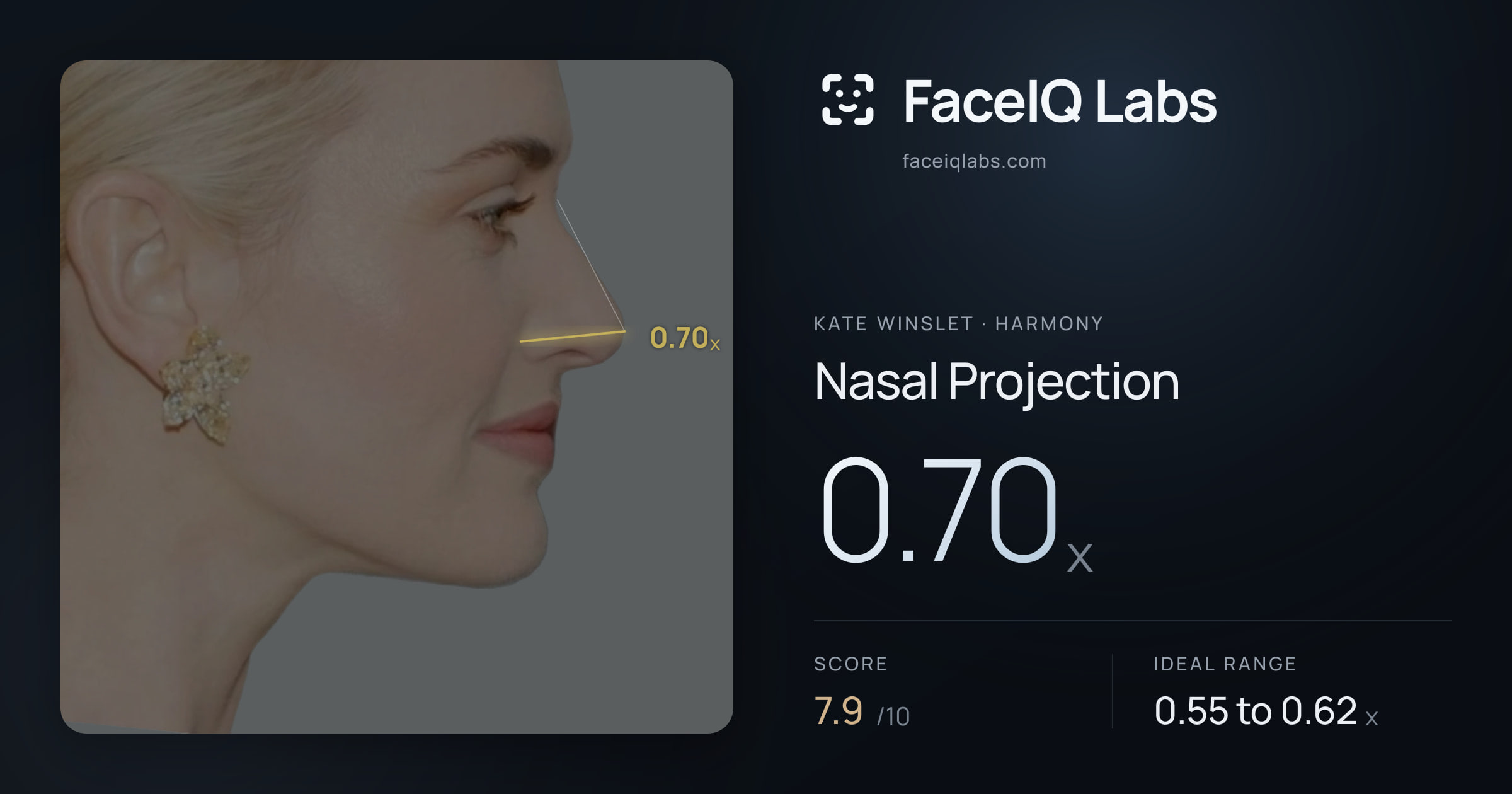 Kate Winslet Nasal Projection: 0.70x, drawn on the photo