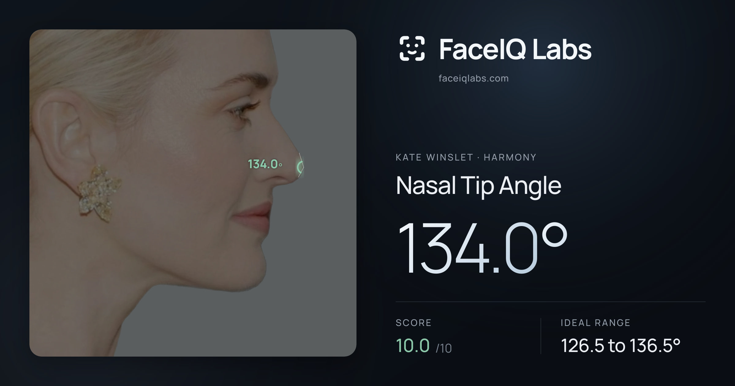 Kate Winslet Nasal Tip Angle: 134.0°, drawn on the photo