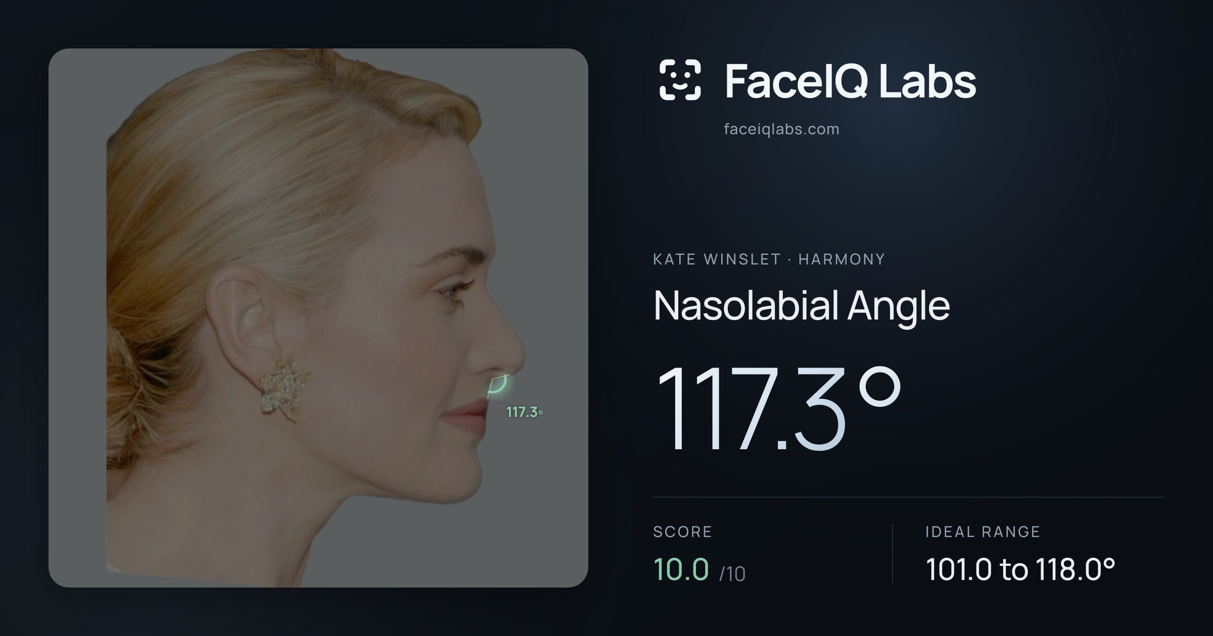 Kate Winslet Nasolabial Angle: 117.3°, drawn on the photo