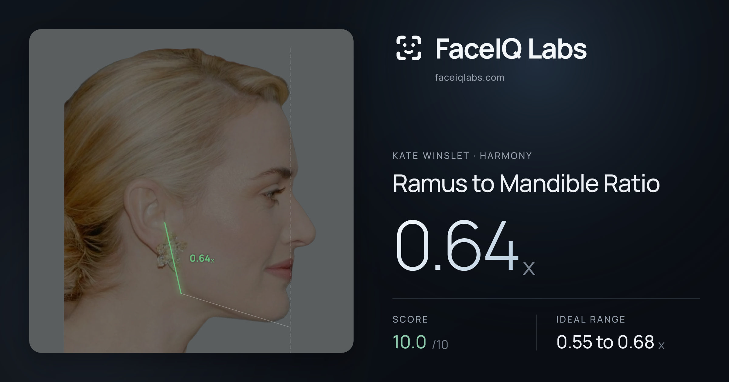 Kate Winslet Ramus to Mandible Ratio: 0.64x, drawn on the photo