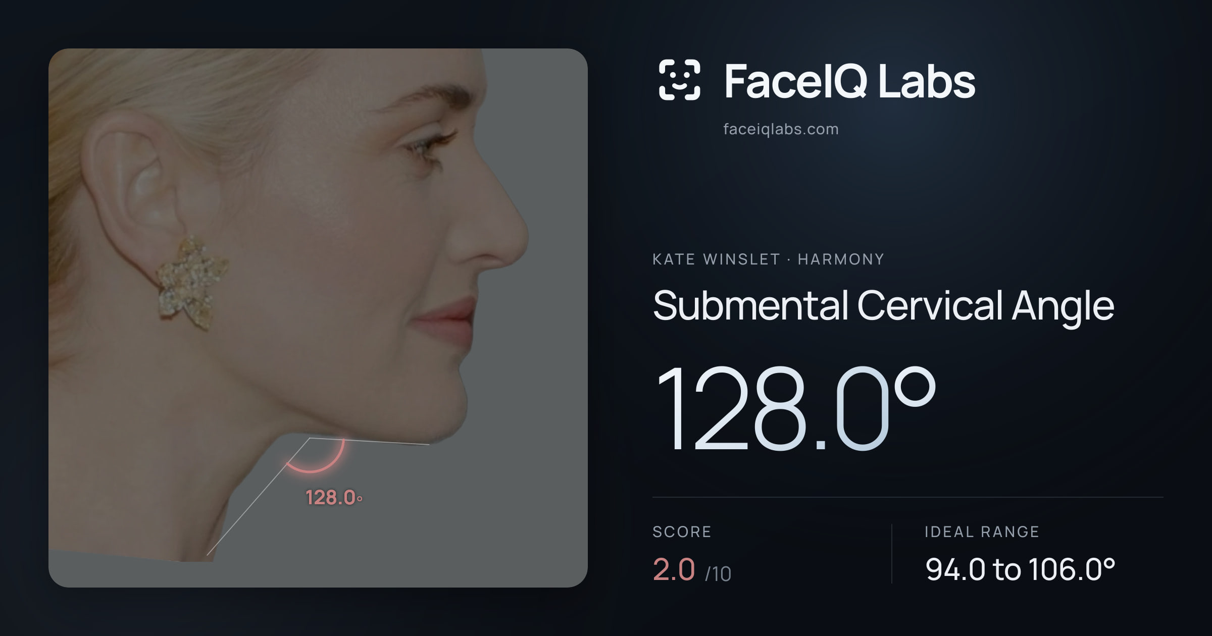 Kate Winslet Submental Cervical Angle: 128.0°, drawn on the photo