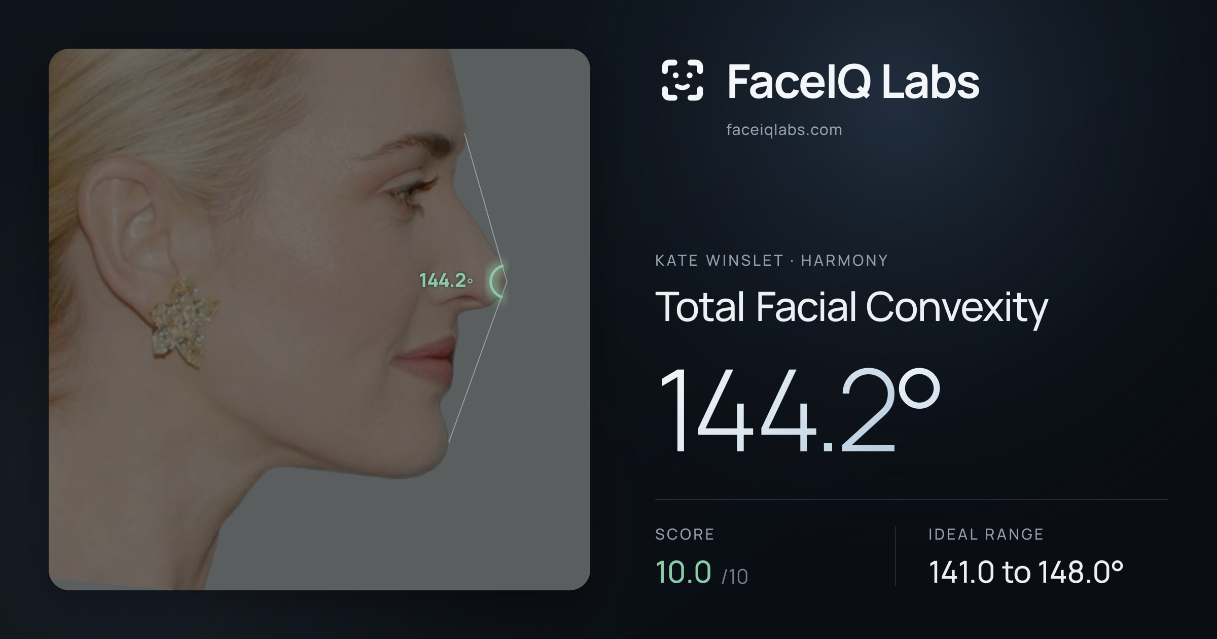 Kate Winslet Total Facial Convexity: 144.2°, drawn on the photo