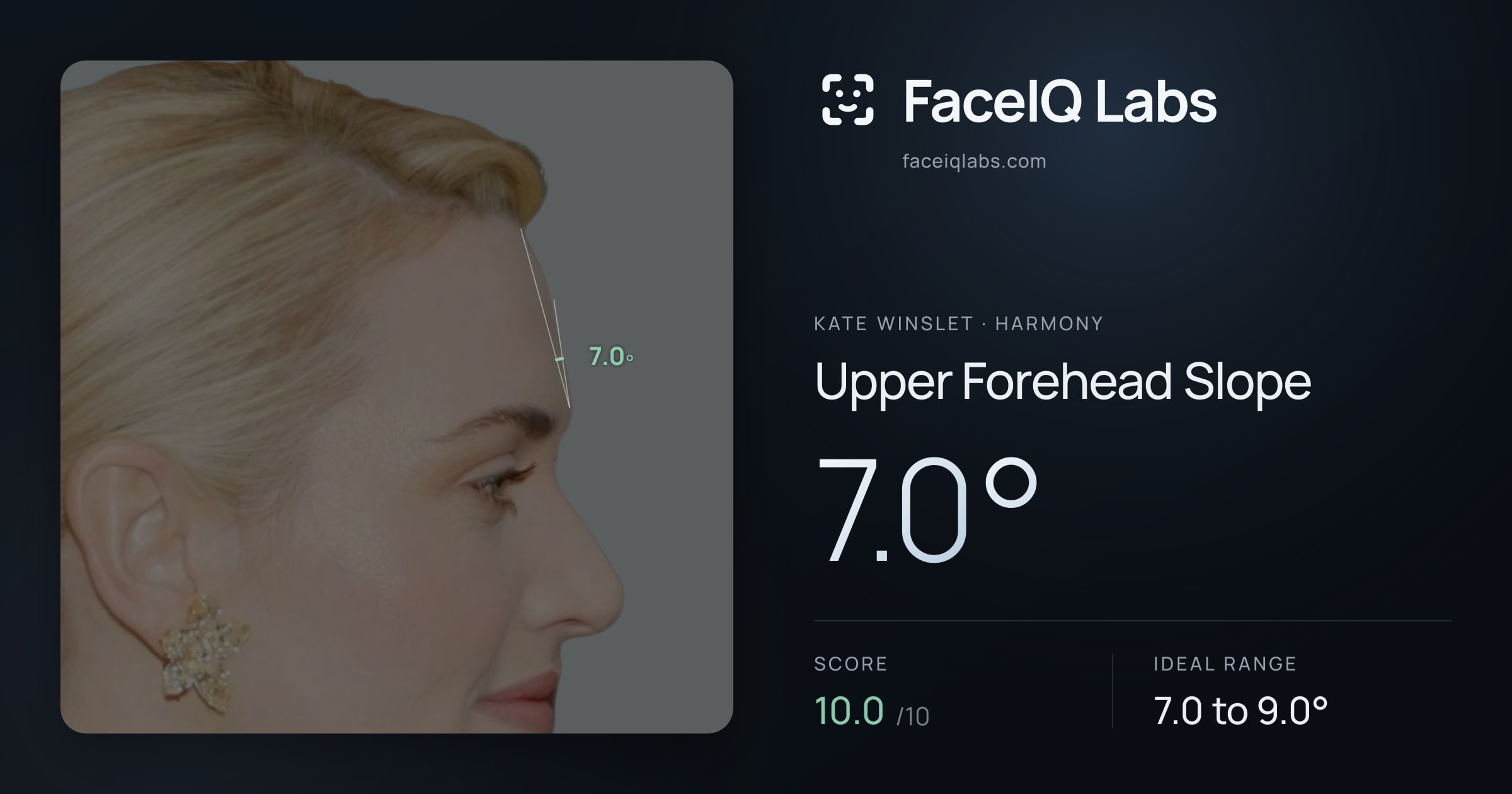 Kate Winslet Upper Forehead Slope: 7.0°, drawn on the photo